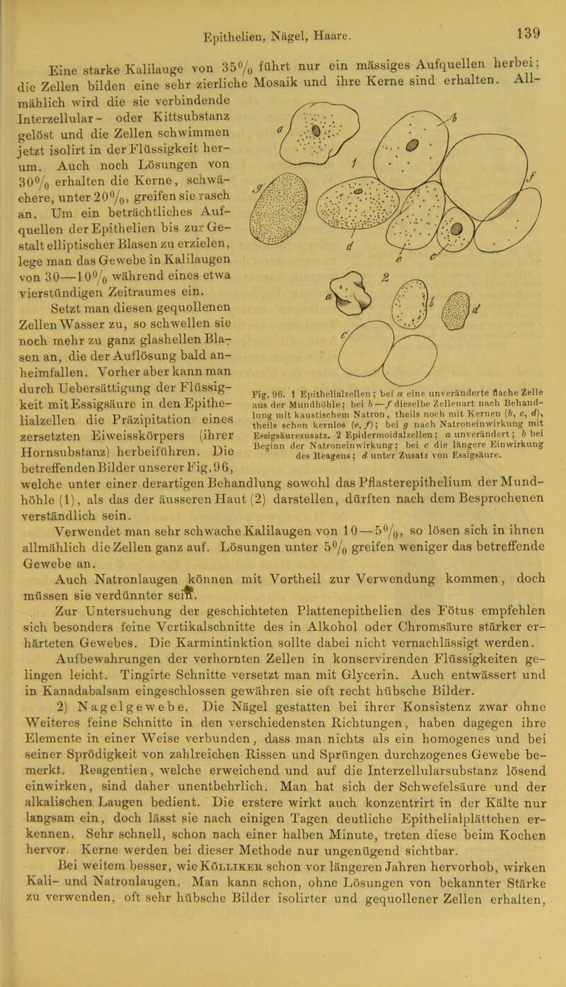 Eine starke Kalilauge von 35% führt nur ein massiges Aufquellen herbei; die Zellen bilden eine sehr zierliche Mosaik und ihre Kerne sind erhalten. All- mählich wird die sie verbindende Interzellular- oder Kittsubstanz gelöst und die Zellen schwimmen jetzt isolirt in der Flüssigkeit her- um. Auch noch Lösungen von 30% erhalten die Kerne, schwä- chere, unter 20%, greifen sie rasch an. Um ein beträchtliches Auf- quellen der Epithelien bis zur Ge- stalt elliptischer Blasen zu erzielen, lege man das Gewebe in Kalilaugen von 30—10% während eines etwa vierstündigen Zeitraumes ein. Setzt man diesen gequollenen Zellen Wasser zu, so schwellen sie noch mehr zu ganz glashellen Blar sen an, die der Auflösung bald an- heimfallen . Vorher aber kann man durch Uebersättigung der Flüssig- keit mit Essigsäure in den Epithe- lialzellen die Präzipitation eines zersetzten Eiweisskörpers (ihrer Hornsubstanz) herbeiführen. Die betreffenden Bilder unserer Fig.96, Fig. 96. 1 Epithelialzellen ; bei a eine unveränderte flache Zelle aus der Mundhöhle; bei b—f dieselbe Zellenart nach Behand- lung mit kaustischem Natron, theils noch mit Kernen (6, c, d), theils schon kernlos (e, f); bei g nach Natroneinwirkung mit Essigsäurezusatz. 2 Epidermoidalzellen; fl unverändert; h bei Beginn der Natroneinwirkung; bei c die längere Einwirkung des Reagens ; d unter Zusatz von Essigsäure. WV»* -J-, - - “7 welche unter einer derartigen Behandlung sowohl das Pflasterepithelium der Mund- höhle (1), als das der äusseren Haut (2) darstellen, dürften nach dem Besprochenen verständlich sein. Verwendet man sehr schwache Kalilaugen von 10 — 5%, so lösen sich in ihnen allmählich die Zellen ganz auf. Lösungen unter 5% greifen weniger das betreffende Gewebe an. Auch Natronlaugen können mit Vortheil zur Verwendung kommen, doch müssen sie verdünnter seift. Zur Untersuchung der geschichteten Plattenepithelien des Fötus empfehlen sich besonders feine Vertikalschnitte des in Alkohol oder Chromsäure stärker er- härteten Gewebes. Die Karmintinktion sollte dabei nicht vernachlässigt werden. Aufbewahrungen der verhornten Zellen in konservirenden Flüssigkeiten ge- lingen leicht. Tingirte Schnitte versetzt man mit Glycerin. Auch entwässert und in Kanadabalsam eingeschlossen gewähren sie oft recht hübsche Bilder. 2) Nagelgewebe. Die Nägel gestatten bei ihrer Konsistenz zwar ohne Weiteres feine Schnitte in den verschiedensten Richtungen, haben dagegen ihre Elemente in einer Weise verbunden, dass man nichts als ein homogenes und bei seiner Sprödigkeit von zahlreichen Rissen und Sprüngen durchzogenes Gewebe be- merkt. Reagentien, welche erweichend und auf die Interzellularsubstanz lösend einwirken, sind daher unentbehrlich. Man hat sich der Schwefelsäure und der alkalischen Laugen bedient. Die erstere wirkt auch konzentrirt in der Kälte nur langsam ein, doch lässt sie nach einigen Tagen deutliche Epithelialplättchen er- kennen. Sehr schnell, schon nach einer halben Minute, treten diese beim Kochen hervor. Kerne werden bei dieser Methode nur ungenügend sichtbar. Bei weitem besser, wie Kölliker schon vor längeren Jahren hervorhob, wirken Kali- und Natronlaugen. Man kann schon, ohne Lösungen von bekannter Stärke zu verwenden, oft sehr hübsche Bilder isolirter und gequollener Zellen erhalten,