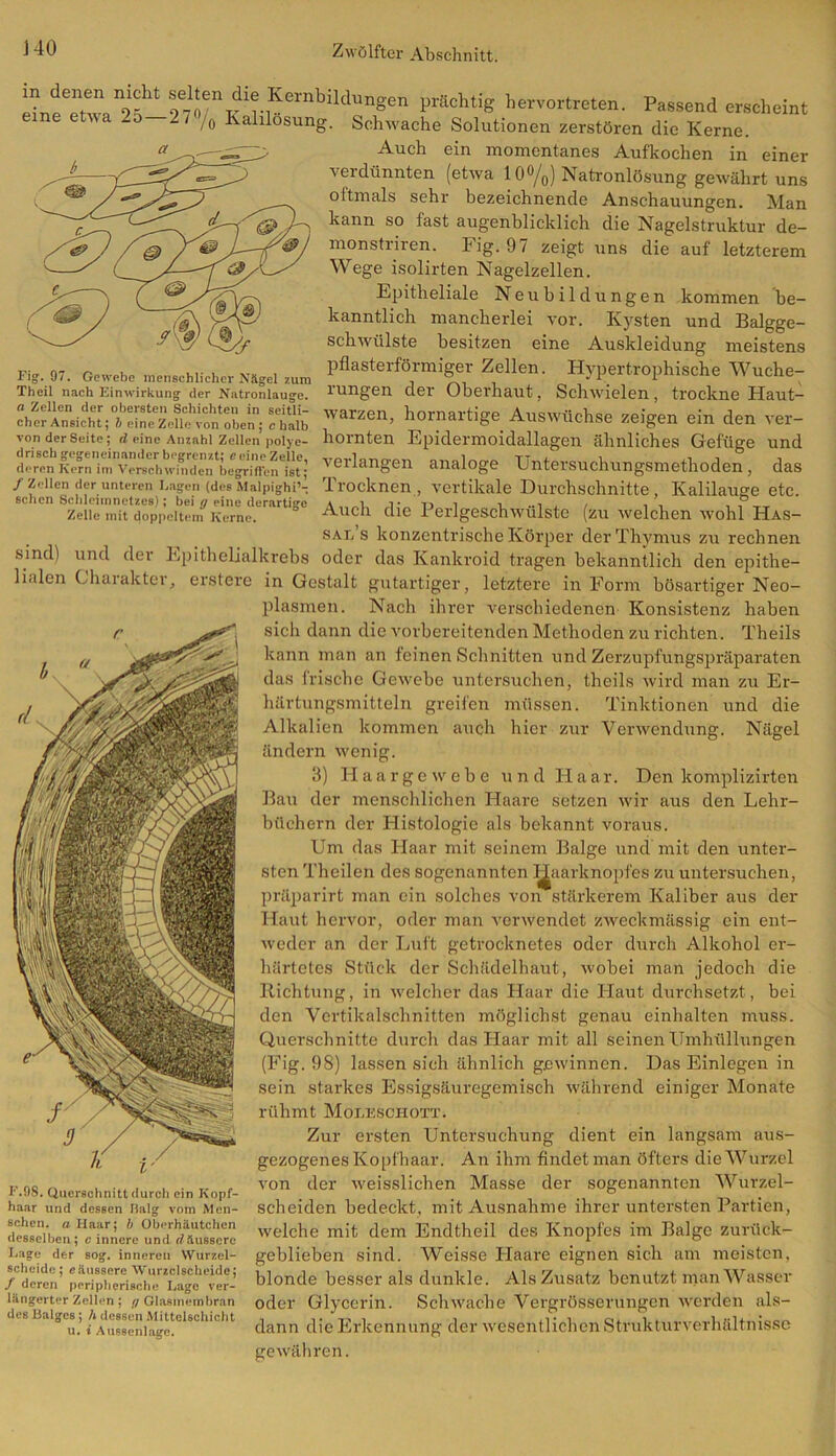 Fig. 97. Gewebe menschlicher Nägel zum Theil nach Einwirkung der Natronlauge, n Zellen der obersten Schichten in seitli- cher Ansicht; b eine Zelle von oben ; c halb lineTwa ”2^ “ fr ,KcrnbUdu nSen prächtig hervortreten. Passend erscheint eine etua -5 2/ /0 Kalllosung. Schwache Solutionen zerstören die Kerne. Auch ein momentanes Aufkochen in einer verdünnten (etwa 10%) Natronlösung gewährt uns oftmals sehr bezeichnende Anschauungen. Man kann so fast augenblicklich die Nagelstruktur de- monstriren. Fig. 97 zeigt uns die auf letzterem Wege isolirten Nagelzellen. Epitheliale Neubildungen kommen be- kanntlich mancherlei vor. Kysten und Balgge- schwülste besitzen eine Auskleidung meistens pflasterförmiger Zellen. Hypertrophische Wuche- rungen der Oberhaut, Schwielen, trockne Haut- warzen, hornartige Auswüchse zeigen ein den ver- von der Seite ; d eine Anzahl Zellen poiye- hörnten Epidermoidallagen ähnliches Gefüge und deren*Korn^m’vprechwu^den^e^i'fftn^st; ver^angen analoge Untersuchungsmethoden, das /Zellen der unteren Lagen (des Malpighi’l Trocknen, vertikale Durchschnitte, Kalilauge etc. schon Schleunnetzes); bei g eine derartige a „„K 3- T) 1 , .., , , , , , ® _ Zelle mit doppeltem Kerne. Auch die I erlgeschwulste (zu welchen wohl Has- sal s konzentrische Körper der Thymus zu rechnen sind) und der Epithelialkrebs oder das Kankroid tragen bekanntlich den epithe- lialen Charakter, erstere in Gestalt gutartiger, letztere in Form bösartiger Neo- plasmen. Nach ihrer verschiedenen Konsistenz haben sicli dann die vorbereitenden Methoden zu richten. Theils kann man an feinen Schnitten und Zerzupfungspräparaten das frische Gewebe untersuchen, theils wird man zu Er- härtungsmitteln greifen müssen. Tinktionen und die Alkalien kommen auch hier zur Verwendung. Nägel ändern wenig. 3) Haargewebe u n d H a a r. Den komplizirtcn Bau der menschlichen Haare setzen wir aus den Lehr- büchern der Histologie als bekannt voraus. Um das Haar mit seinem Balge und mit den unter- sten Theilen des sogenannten IJaarknopfes zu untersuchen, präparirt man ein solches von stärkerem Kaliber aus der Haut hervor, oder man verwendet zweckmässig ein ent- weder an der Luft getrocknetes oder durch Alkohol er- härtetes Stück der Schädelhaut, wobei man jedoch die Richtung, in welcher das Haar die Haut durchsetzt, bei den Vertikalschnitten möglichst genau einhalten muss. Querschnitte durch das Haar mit all seinen Umhüllungen (Fig. 98) lassen sich ähnlich gewinnen. Das Einlegen in sein starkes Essigsäuregemisch während einiger Monate rühmt Moleschott. Zur ersten Untersuchung dient ein langsam aus- gezogenes Kopfhaar. An ihm findet man öfters die Wurzel von der weisslichen Masse der sogenannten Wurzel- scheiden bedeckt, mit Ausnahme ihrer untersten Partien, welche mit dem Endtheil des Knopfes im Balge zurück- geblieben sind. Weisse Haare eignen sich am meisten, blonde besser als dunkle. Als Zusatz benutzt man Wasser oder Glycerin. Schwache Vergrösserungen werden als- dann die Erkennung der wesentlichen Strukturverhältnisse gewähren. J.98. Querschnitt durch ein Kopf- haar und dessen Balg vom Men- schen. a Haar; b Oberhäutchen desselben; c innere und däussere Lage der sog. inneren Wurzel- scheide; e äussere Wurzclscheide; / deren peripherische Lage ver- längerter Zellen; g Glasmembran des Balges; h dessen Mittelschicht u. i Aussenlagc.