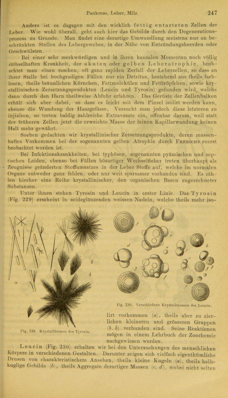 Anders ist es dagegen mit den wirklich fettig entarteten Zellen der Leber. Wie wohl überall, geht auch hier das Gebilde durch den Degenerations- prozess zu Grunde. Man findet eine derartige Umwandlung meistens nur an be- schränkten Stellen des Lebergewebes, in der Nähe von Entzündungsheerden oder Geschwülsten. Bei einer sehr merkwürdigen und in ihren kausalen Momenten noch völlig räthselhaften Krankheit, der akuten oder gelben Leberatrophie, beob- achtet man einen raschen, oft ganz rapiden Zerfall der Leberzellen, so dass an ihrer Stelle bei hochgradigen Fällen nur ein Detritus, bestehend aus theils farb- losen, theils bräunlichen Körnchen, Fettmolekülen und Fetttröpfchen, sowie kry- stallinischen Zersetzungsprodukten (Leucin und Tyrosin) gefunden wird, welche dann durch den Harn theilweise Abfuhr erfahren. Das Gerüste der Zellenbalken erhält sich aber dabei, so dass es leicht mit dem Pinsel isolirt werden kann, ebenso die Wandung der Haargefässe. Versucht man jedoch diese letzteren zu injiziren, so treten baldig zahlreiche Extravasate ein, offenbar darum, weil statt der früheren Zellen jetzt die erweichte Masse der feinen Kapillarwandung keinen Halt mehr gewährt. Soeben gedachten wir krystallinischer Zersetzungsprodukte, deren massen- haftes Vorkommen bei der sogenannten gelben Atrophie durch Fbekichs zuerst beobachtet worden ist. Bei Infektionskrankheiten, bei typhösen, sogenannten pyämischen und sep- tischen Leiden, ebenso bei Fällen bösartiger Wechselfieber treten überhaupt als • Zeugnisse geänderten Stoffumsatzes in der Leber Stoffe auf, welche im normalen Organe entweder ganz fehlen, oder nur weit sparsamer vorhanden sind. Es zäh- len hierher eine Reihe krystallinischer, den organischen Basen zugerechneter Substanzen. Unter ihnen stehen Tyrosin und Leucin in erster Linie. Das Tyrosin (Fig. 229) erscheint in seideglänzenden weissen Nadeln, welche theils mehr iso- Fig. 230. Verschiedene Krystallmassen des Leucin. Fig. 229. Kr) stallformen des Tyrosin. lirt Vorkommen (a), theils aber zu zier- lichen kleineren und grösseren Gruppen (b. b) verbunden sind. Seine Reaktionen mögen in einem Lehrbuch der Zoochemie nachgewiesen werden. Leucin (Fig. 230) erhalten wir bei den Untersuchungen des menschlichen Körpers in verschiedenen Gestalten. Darunter zeigen sich vielfach eigenthümliche Drusen von charakteristischem Ansehen, theils kleine Kugeln (a), theils halb- kuglige Gebilde (b), theils Aggregate derartiger Massen (c, d), wobei nicht selten