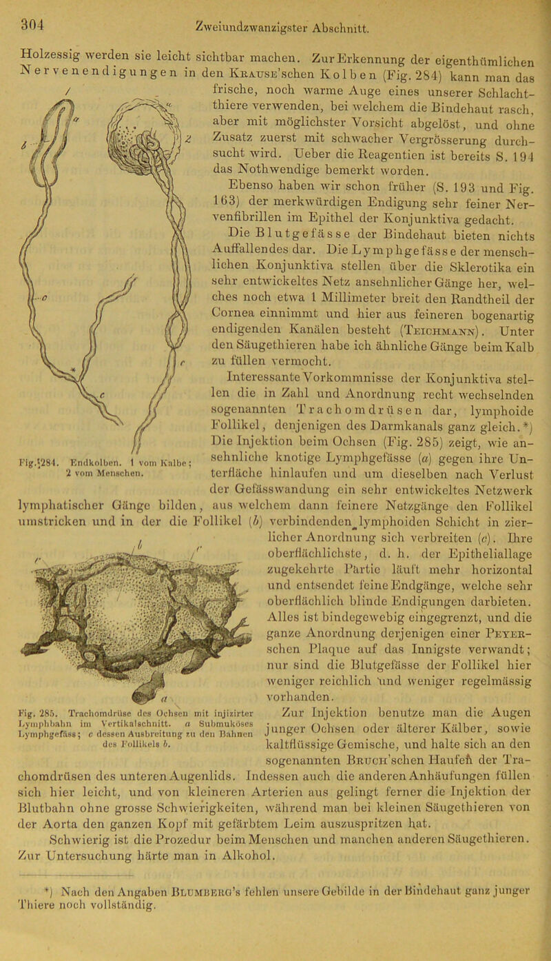 Holzessig werden sie leicht sichtbar machen. Zur Erkennung der eigentümlichen Nervenendigungen in den Krause’sehen Kolben (Fig. 284) kann man das frische, noch warme Auge eines unserer Schlacht- thiere verwenden, bei welchem die Bindehaut rasch, aber mit möglichster Vorsicht abgelöst, und ohne Zusatz zuerst mit schwacher \ ergrösserung durch- sucht wird. Ueber die Reagentien ist bereits S. 194 das Notwendige bemerkt worden. Ebenso haben wir schon früher (S. 193 und Fig. 163) der merkwürdigen Endigung sehr feiner Ner- venfibrillen im Epithel der Konjunktiva gedacht. Die Blutgefässe der Bindehaut bieten nichts Auffallendes dar. Die Lymphgefässe der mensch- lichen Konjunktiva stellen über die Skierotika ein sehr entwickeltes Netz ansehnlicher Gänge her, wel- ches noch etwa 1 Millimeter breit den Randtheil der Cornea einnimmt und hier aus feineren bogenartig endigenden Kanälen besteht (Teichmann). Unter den Säugetieren habe ich ähnliche Gänge beim Kalb zu füllen vermocht. Interessante Vorkommnisse der Konjunktiva stel- len die in Zahl und Anordnung recht wechselnden sogenannten Trachomdrüsen dar, lymphoide Follikel, denjenigen des Darmkanals ganz gleich.*) Die Injektion beim Ochsen (Fig. 285) zeigt, wie an- sehnliche knotige Lymphgefässe (a) gegen ihre Un- terfläche hinlaufen und um dieselben nach Verlust der Gefässwandung ein sehr entwickeltes Netzwerk lymphatischer Gänge bilden, aus welchem dann feinere Netzgänge den Follikel umstricken und in der die Follikel (ä) verbindenden^lymphoiden Schicht in zier- licher Anordnung sich verbreiten (c). Ihre oberflächlichste, d. h. der Epitheliallage zugekehrte Partie läuft mehr horizontal und entsendet feine Endgänge, welche sehr oberflächlich blinde Endigungen darbieten. Alles ist bindegewebig eingegrenzt, und die ganze Anordnung derjenigen einer Peyer- schen Plaque auf das Innigste verwandt; nur sind die Blutgefässe der Follikel hier weniger reichlich und weniger regelmässig vorhanden. Zur Injektion benutze man die Augen junger Ochsen oder älterer Kälber, sowie kaltflüssige Gemische, und halte sich an den sogenannten BRUciPschen Häufelt der Tra- chomdrüsen des unteren Augenlids. Indessen auch die anderen Anhäufungen füllen sich hier leicht, und von kleineren Arterien aus gelingt ferner die Injektion der Blutbahn ohne grosse Schwierigkeiten, während man bei kleinen Säugethieren von der Aorta den ganzen Kopf mit gefärbtem Leim auszuspritzen l\at. Schwierig ist die Prozedur beim Menschen und manchen anderen Säugethieren. Zur Untersuchung härte man in Alkohol. Fig.$284. Emlkolbon. 1 vom Kalbe; 2 vom Menschen. Fig. 285. Trachomdrüse des Ochsen mit injizirter Lymphbahn im Vertikalschnitt. a Suhmuküses I.ymphgcfäss; c dessen Ausbreitung zu den Dahnen des Follikels b. f) Nach den Angaben Blumderg’s fehlen unsere Gebilde in der Bindehaut ganz junger Thiere noch vollständig.