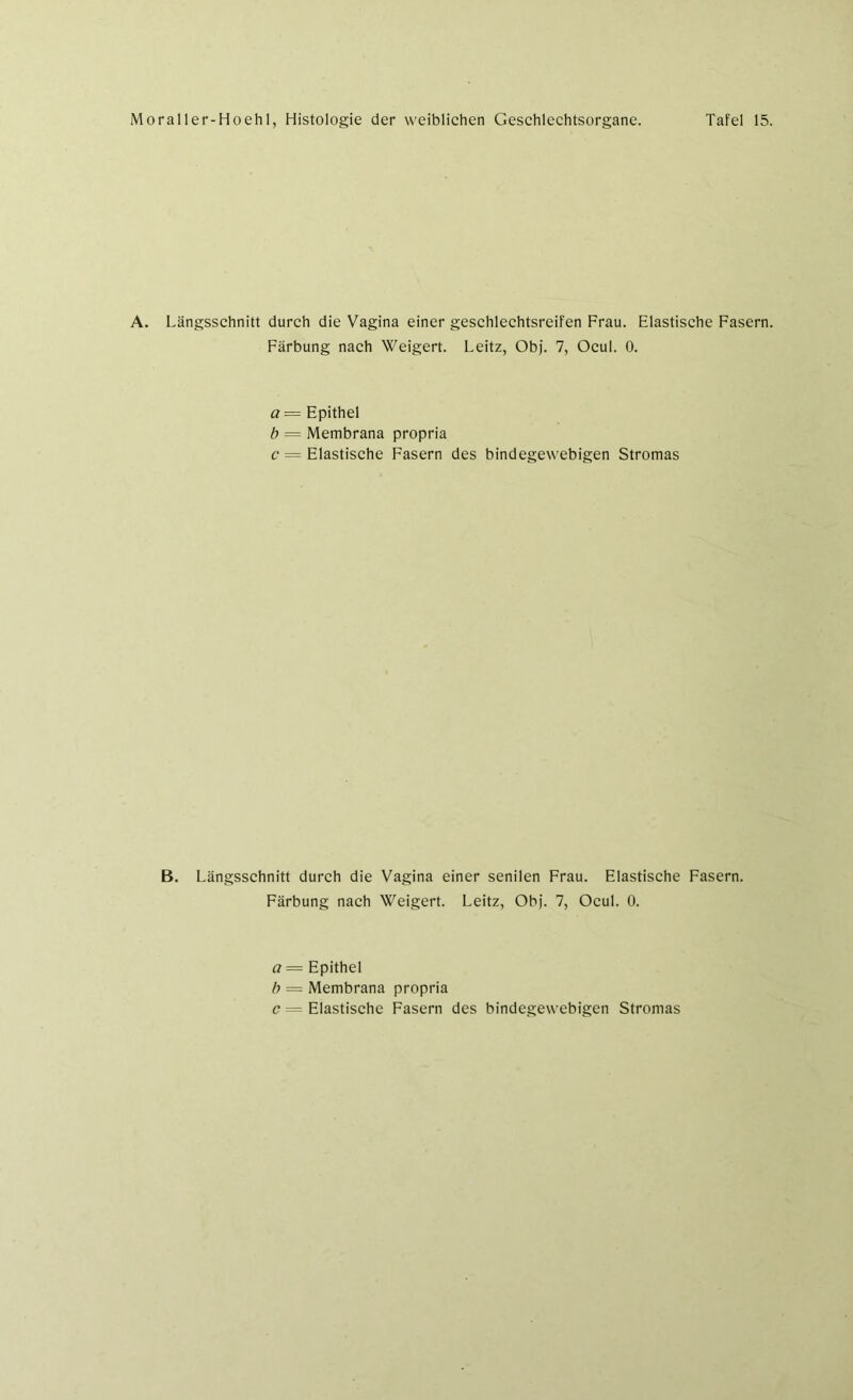 A. Längsschnitt durch die Vagina einer geschlechtsreifen Frau. Elastische Fasern. Färbung nach Weigert. Leitz, Ob). 7, Ocul. 0. a = Epithel b = Membrana propria c = Elastische Fasern des bindegewebigen Stromas B. Längsschnitt durch die Vagina einer senilen Frau. Elastische Fasern. Färbung nach Weigert. Leitz, Obj. 7, Ocul. 0. a— Epithel b = Membrana propria c = Elastische Fasern des bindegewebigen Stromas