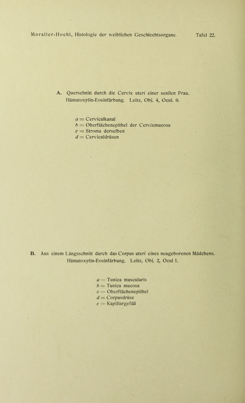 A. Querschnitt durch die Cervix Uteri einer senilen Frau. Hämatoxplin-Eosinfärbung. Leitz, Obj. 4, Ocul. 0. a = Cervicalkanal b = Oberflächenepithel der Cervixmucosa c = Stroma derselben d = Cervicaldrüsen B. Aus einem Längsschnitt durch das Corpus Uteri eines neugeborenen Mädchens. Hämatoxplin-Eosinfärbung. Leitz, Obj. 2, Ocul 1. a= Tunica muscularis b — Tunica mucosa c = Oberflächenepithel d— Corpusdrüse e = Kapillargefäß