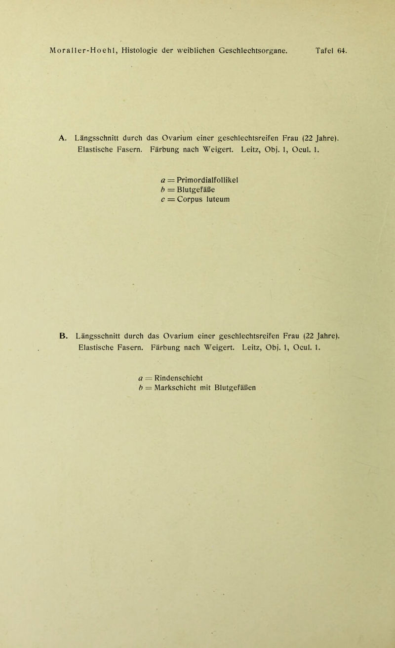 A. Längsschnitt durch das Ovarium einer geschlechtsreifen Frau (22 Jahre) Elastische Fasern. Färbung nach Weigert. Leitz, Obj. 1, Ocul. 1. a = Primordialfollikel b = Blutgefäße c — Corpus luteum B. Längsschnitt durch das Ovarium einer geschlechtsreifen Frau (22 Jahre). Elastische Fasern. Färbung nach Weigert. Leitz, Obj. 1, Ocul. 1. a = Rindenschicht b — Markschicht mit Blutgefäßen