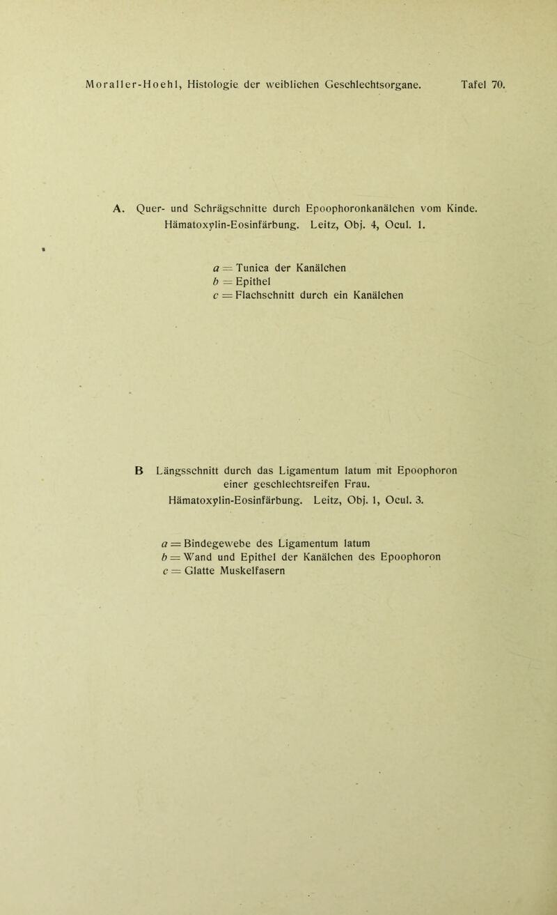 A. Quer- und Schrägschnitte durch Epoophoronkanälchen vom Kinde. Hämatoxylin-Eosinfärbung. Leitz, Obj. 4, Ocul. 1. a = Tunica der Kanälchen b — Epithel c = Flachschnitt durch ein Kanälchen B Längsschnitt durch das Ligamentum latum mit Epoophoron einer geschlechtsreifen Frau. Hämatoxylin-Eosinfärbung. Leitz, Obj. 1, Ocul. 3. a — Bindegewebe des Ligamentum latum b = Wand und Epithel der Kanälchen des Epoophoron c = Glatte Muskelfasern