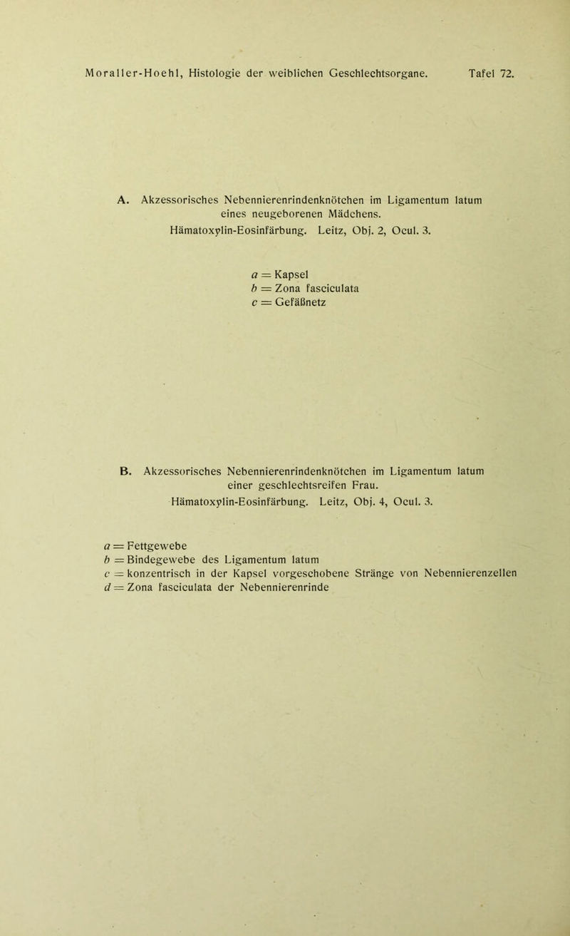 A. Akzessorisches Nebennierenrindenknötchen im Ligamentum latum eines neugeborenen Mädchens. Hämatoxylin-Eosinfärbung. Leitz, Ob). 2, Ocul. 3. a = Kapsel b = Zona fasciculata c — Gefäßnetz B. Akzessorisches Nebennierenrindenknötchen im Ligamentum latum einer geschlechtsreifen Frau. Hämatoxylin-Eosinfärbung. Leitz, Obj. 4, Ocul. 3. a - Fettgewebe b — Bindegewebe des Ligamentum latum c = konzentrisch in der Kapsel vorgeschobene Stränge von Nebennierenzellen tf = Zona fasciculata der Nebennierenrinde