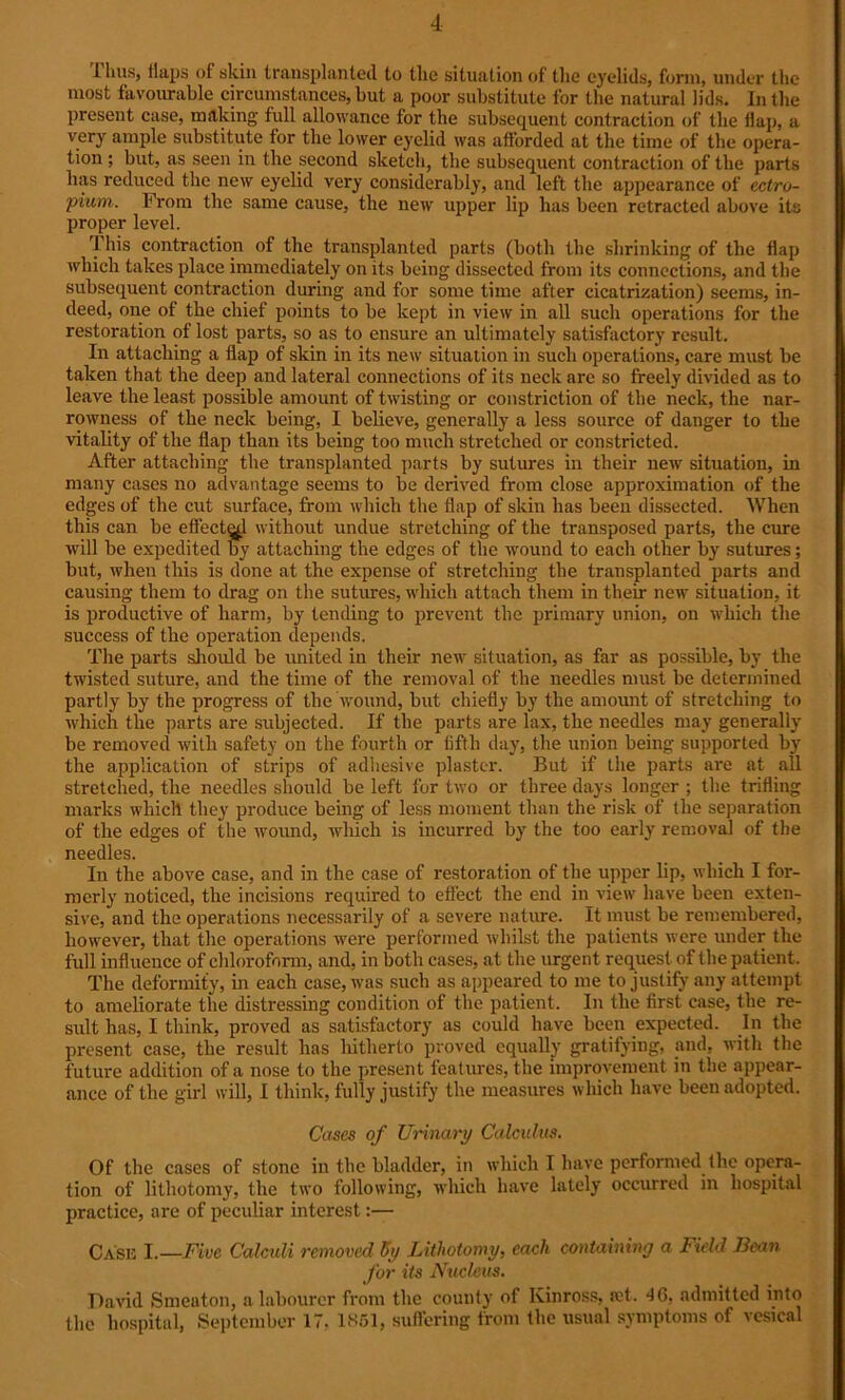 11ms, Haps of skin transplanted to the situation of the eyelids, form, under the most favourable circumstances, but a poor substitute for the natural lids. In the present case, making full allowance for the subsequent contraction of the flap, a very ample substitute for the lower eyelid was afforded at the time of the opera- tion ; but, as seen in the second sketch, the subsequent contraction of the parts has reduced the new eyelid very considerably, and left the appearance of ectro- pium. From the same cause, the new upper lip has been retracted above its proper level. This contraction of the transplanted parts (both the shrinking of the flap which takes place immediately on its being dissected from its connections, and the subsequent contraction during and for some time after cicatrization) seems, in- deed, one of the chief points to be kept in view in all such operations for the restoration of lost parts, so as to ensure an ultimately satisfactory result. In attaching a flap of skin in its new situation in such operations, care must be taken that the deep and lateral connections of its neck arc so freely divided as to leave the least possible amount of twisting or constriction of the neck, the nar- rowness of the neck being, I believe, generally a less source of danger to the vitality of the flap than its being too much stretched or constricted. After attaching the transplanted parts by sutures in their new situation, in many cases no advantage seems to be derived from close approximation of the edges of the cut surface, from which the flap of skin has been dissected. When this can be effecta.1 without undue stretching of the transposed parts, the cure will be expedited by attaching the edges of the wound to each other by sutures; but, when this is done at the expense of stretching the transplanted parts and causing them to drag on the sutures, which attach them in their new situation, it is productive of harm, by tending to prevent the primary union, on which the success of the operation depends. The parts should be united in their new situation, as far as possible, by the twisted suture, and the time of the removal of the needles must be determined partly by the progress of the wound, but chiefly by the amount of stretching to which the parts are subjected. If the parts are lax, the needles may generally be removed with safety on the fourth or fifth day, the union being supported by the application of strips of adhesive plaster. But if the parts are at all stretched, the needles should be left for two or three days longer ; the trifling marks which they produce being of less moment than the risk of the separation of the edges of the wound, which is incurred by the too early removal of the needles. In the above case, and in the case of restoration of the upper lip, which I for- merly noticed, the incisions required to effect the end in view have been exten- sive, and the operations necessarily of a severe nature. It must be remembered, however, that the operations were performed whilst the patients were under the full influence of chloroform, and, in both cases, at the urgent request of the patient. The deformity, hi each case, was such as appeared to me to justify any attempt to ameliorate the distressing condition of the patient. In the first case, the re- sult has, I think, proved as satisfactory as could have been expected. In the present case, the result has hitherto proved equally gratifying, and, with the future addition of a nose to the present features, the improvement in the appear- ance of the girl will, I think, fully justify the measures which have been adopted. Cases of Urinary Calculus. Of the cases of stone in the bladder, in which I have performed the opera- tion of lithotomy, the two following, which have lately occurred in hospital practice, are of peculiar interest:— Case I.—Five Calculi removed 5y Lithotomy, each containing a Field Fean for its Nucleus. David Smeaton, a labourer from the county of Kinross, ret. 46. admitted into the hospital, September 17. 1851, suffering from the usual symptoms of vesical