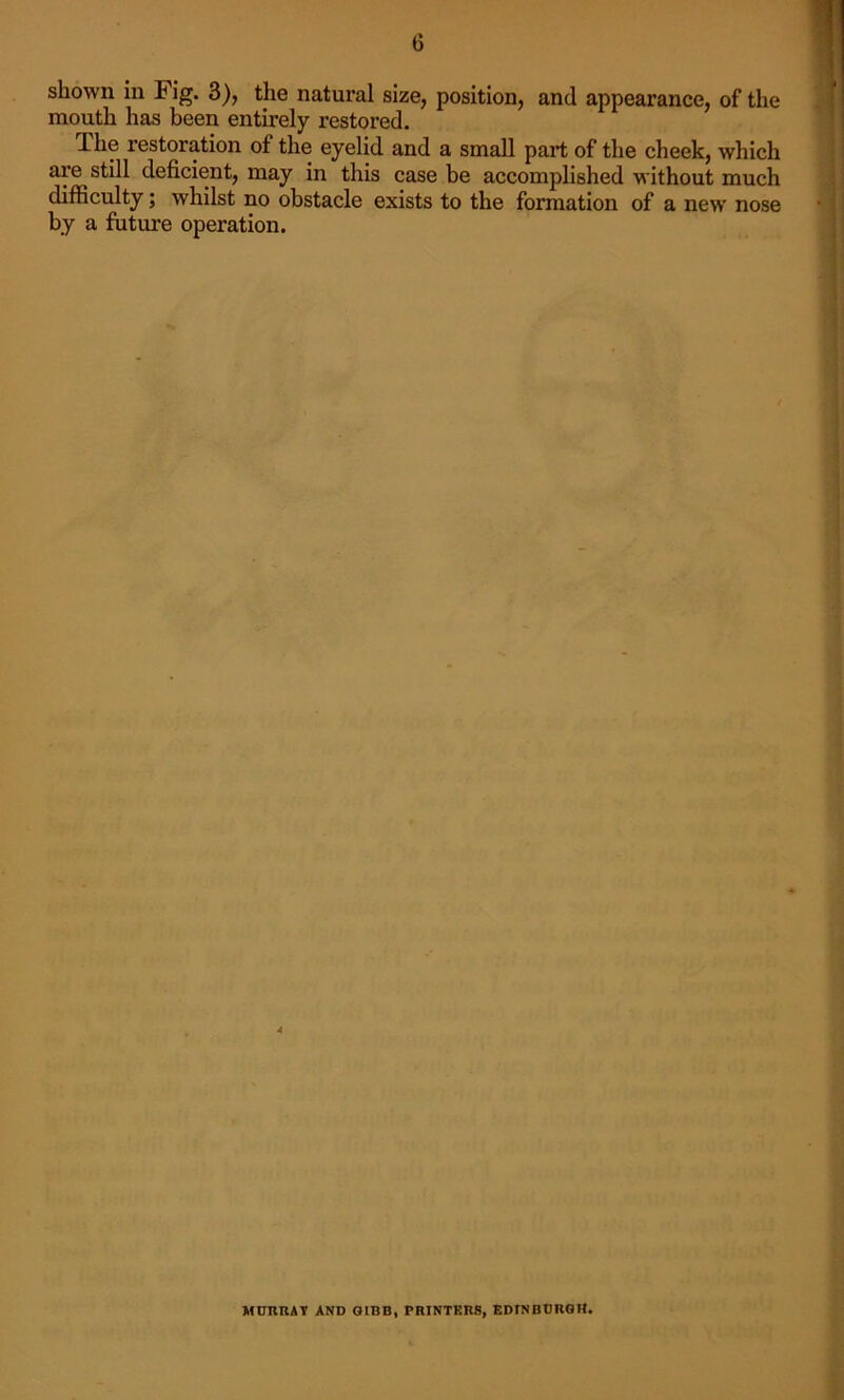 shown in Fig. 3), the natural size, position, and appearance, of the mouth has been entirely restored. dhe restoration of the eyelid and a small part of the cheek, which are still deficient, may in this case be accomplished without much difficulty; whilst no obstacle exists to the formation of a new nose by a future operation. MURRAY AND GIBB, PRINTERS, EDINBURGH.