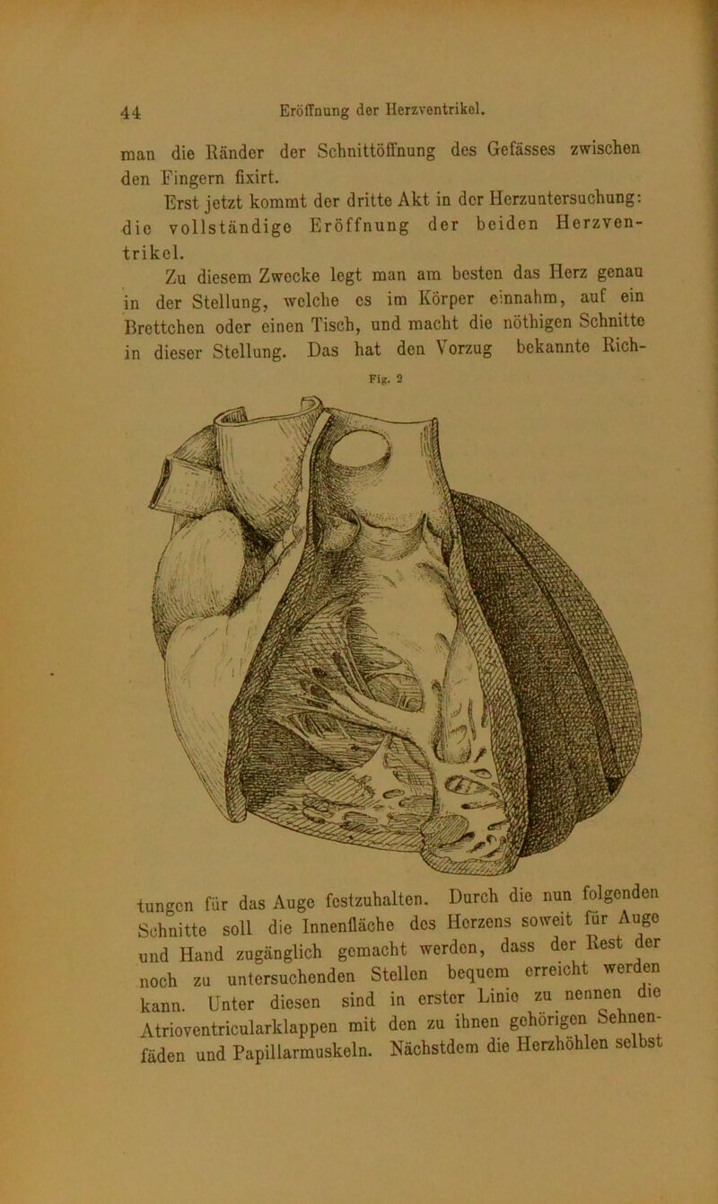 man die Ränder der Schnittöffnung des Gefässes zwischen den Fingern fixirt. Erst jetzt kommt der dritte Akt in der Herzuntersuchung: die vollständige Eröffnung der beiden Herzven- trikel. Zu diesem Zwecke legt man am besten das Herz genau in der Stellung, welche cs im Körper einnahm, auf ein Brettchen oder einen Tisch, und macht die nöthigen »Schnitte in dieser Stellung. Das hat den Vorzug bekannte Rich- Fijt. 2 tunken für das Auge festzuhalten. Durch die nun folgenden Schnitte soll die Innenfläche des Herzens soweit für Auge und Hand zugänglich gemacht werden, dass der Rest er noch zu untersuchenden Stellen bequem erreicht werden kann. Unter diesen sind in erster Limo zu nennen die Atrioventricularklappen mit den zu ihnen gehörigen Sehnen- fäden und Papillarmuskeln. Nächstdem die Herzhöhlen selbst