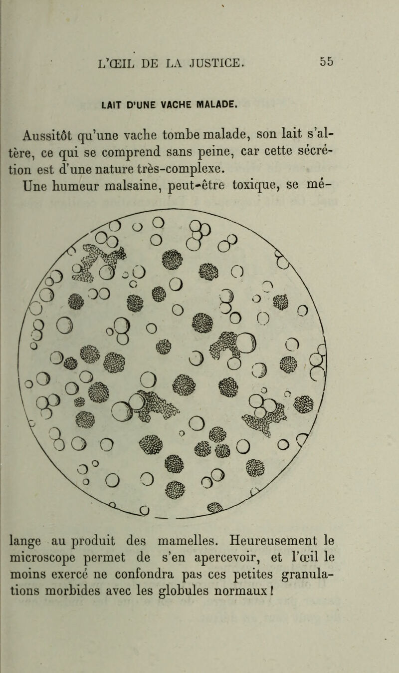LAIT D’UNE VACHE MALADE. Aussitôt qu’une vache tombe malade, son lait s’al- tère, ce qui se comprend sans peine, car cette sécré- tion est d’une nature très-complexe. Une humeur malsaine, peut-être toxique, se mé- lange au produit des mamelles. Heureusement le microscope permet de s’en apercevoir, et l’œil le moins exercé ne confondra pas ces petites granula- tions morbides avec les globules normaux !