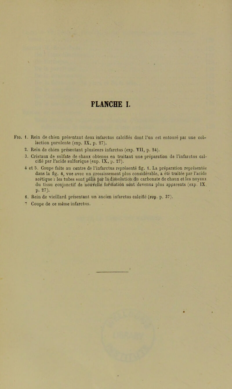 Fig. 1. Rein de chien présentant deux infarctus calcifiés dont l’un est entouré par une col- lection purulente (exp. IX, p. 27). 2. Rein de chien présentant plusieurs infarctus (exp. VII, p. 24). 3. Cristaux de sulfate de chaux obtenus en traitant une préparation de l’infarctus cal- cifié par l’acide sulfurique (exp. IX, p. 27). 4 et 5. Coupe faite au centre de l’infarctus représenté fig. 1. La préparation représentée dans la fig. 4, vue avec un grossissement plus considérable, a été traitée par l’acide acétique : les tubes sont pâlis par la dissolution du carbonate de chaux et les noyaux du tissu conjonctif de nouvelle formation sont devenus plus apparents (exp. IX p. 27). 6. Rein de vieillard présentant un ancien infarctus calcifié (voy. p. 37).