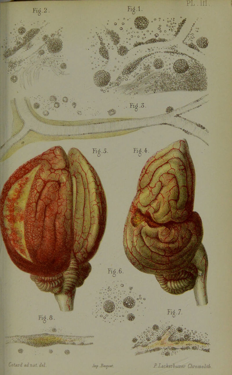 Cotard ad nat. del. lmp Becfjuei. -P.Iackerlaiier ChromoliÜi.