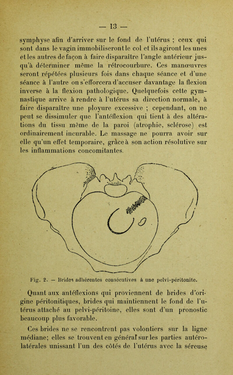 symphyse afin d’arriver sur le fond de rntérns ; ceux qui sont dans le vagin immobiliseront le col et ils agiront les unes et les autres de façon à faire disparaître Tangle antérieur jus- qu’à déterminer meme la rétrocourbure. Ces manœuvres seront répétées plusieurs fois dans chaque séance et d’une séance à l’autre on s’efforcera d’accuser davantage la flexion inverse à la flexion pathologique. Quelquefois cette gym- nastique arrive à rendre à l’iitérus sa direction normale, à faire disparaître une ployure excessive ; cependant, on ne peut se dissimuler que l’antéflexion qui tient à des altéra- tions du tissu meme de la paroi (atrophie, sclérose) est ordinairement incurable. Le massage ne pourra avoir sur elle qu’un effet temporaire, grâce à son action résolutive sur les inflammations concomitantes. Quant aux antéflexions qui proviennent de brides d’ori- gine péritonitiques, brides qui maintiennent le fond de l’ii- térus attaché au pelvi-péritoine, elles sont d’un pronostic beaucoup plus favorable. Ces brides ne se rencontrent pas volontiers sur la ligne médiane; elles se trouvent en général sur les parties antéro- latérales unissant l’im des côtés de Futérus avec la séreuse