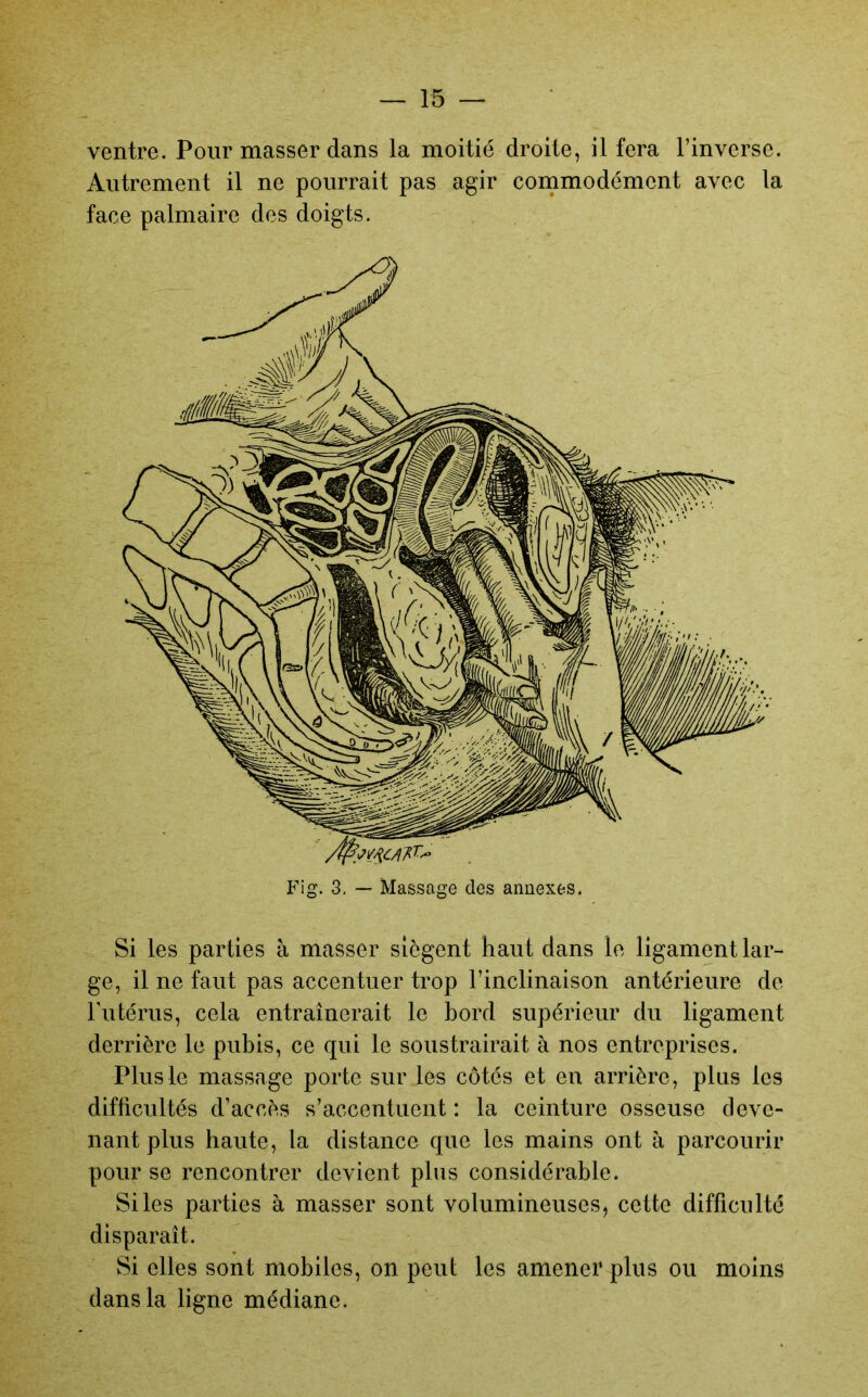 ventre. Pour masser dans la moitié droite, il fera l’inverse. Autrement il ne pourrait pas agir coinmodément avec la face palmaire des doigts. Si les parties à masser siègent haut dans le ligament lar- ge, il ne faut pas accentuer trop l’inclinaison antérieure de Futérus, cela entraînerait le bord supérieur du ligament derrière le pubis, ce qui le soustrairait à nos entreprises. Plus le massage porte sur les côtés et en arrière, plus les difficultés d’accès s’accentuent : la ceinture osseuse deve- nant plus haute, la distance que les mains ont à parcourir pour se rencontrer devient plus considérable. Si les parties à masser sont volumineuses, cette difficulté disparaît. Si elles sont mobiles, on peut les amener plus ou moins dans la ligne médiane.
