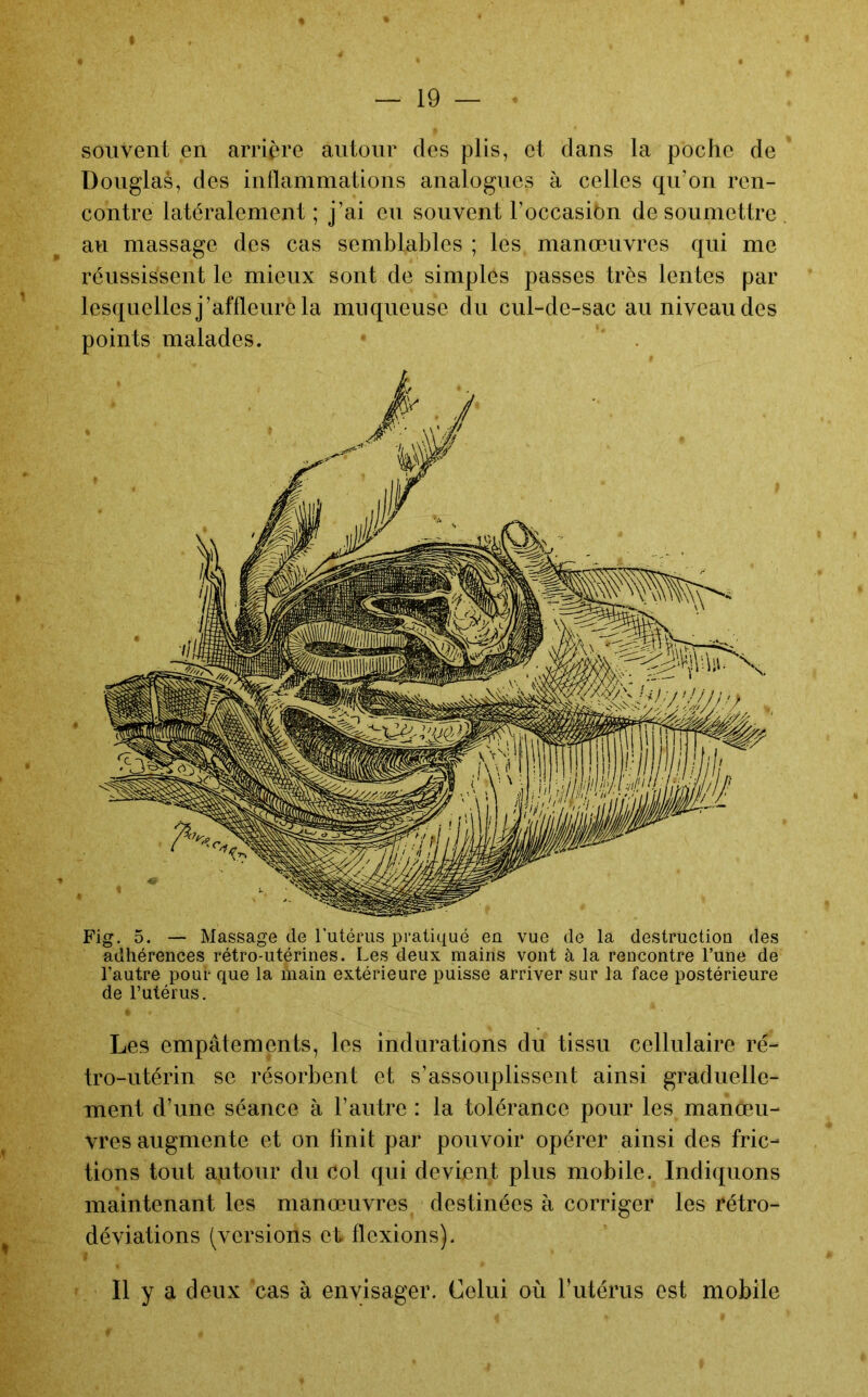 souvent en arrière autour des plis, et dans la poche de Douglas, des inflammations analogues à celles qu’on ren- contre latéralement ; j’ai eu souvent l’occasiOn de soumettre . au massage des cas semblables ; les manœuvres qui me réussissent le mieux sont de simples passes très lentes par lesquelles j’affleure la muqueuse du cul-de-sac au niveau des points malades. Fig. 5. — Massage de l'utérus pratiqué eu vue de la destruction des adhérences rétro-utérines. Les deux mains vont à la rencontre l’une de l’autre pour que la main extérieure puisse arriver sur la face postérieure de Futérus. Les empâtements, les indurations du tissu cellulaire ré- tro-utérin se résorbent et s’assouplissent ainsi graduelle- ment d’une séance à l’autre : la tolérance pour les manœu- vres augmente et on finit par pouvoir opérer ainsi des fric- tions tout autour du col qui devient plus mobile. Indiquons maintenant les manœuvres destinées à corriger les rétro- déviations (versions et flexions). Il y a deux cas à envisager. Celui où futérus est mobile