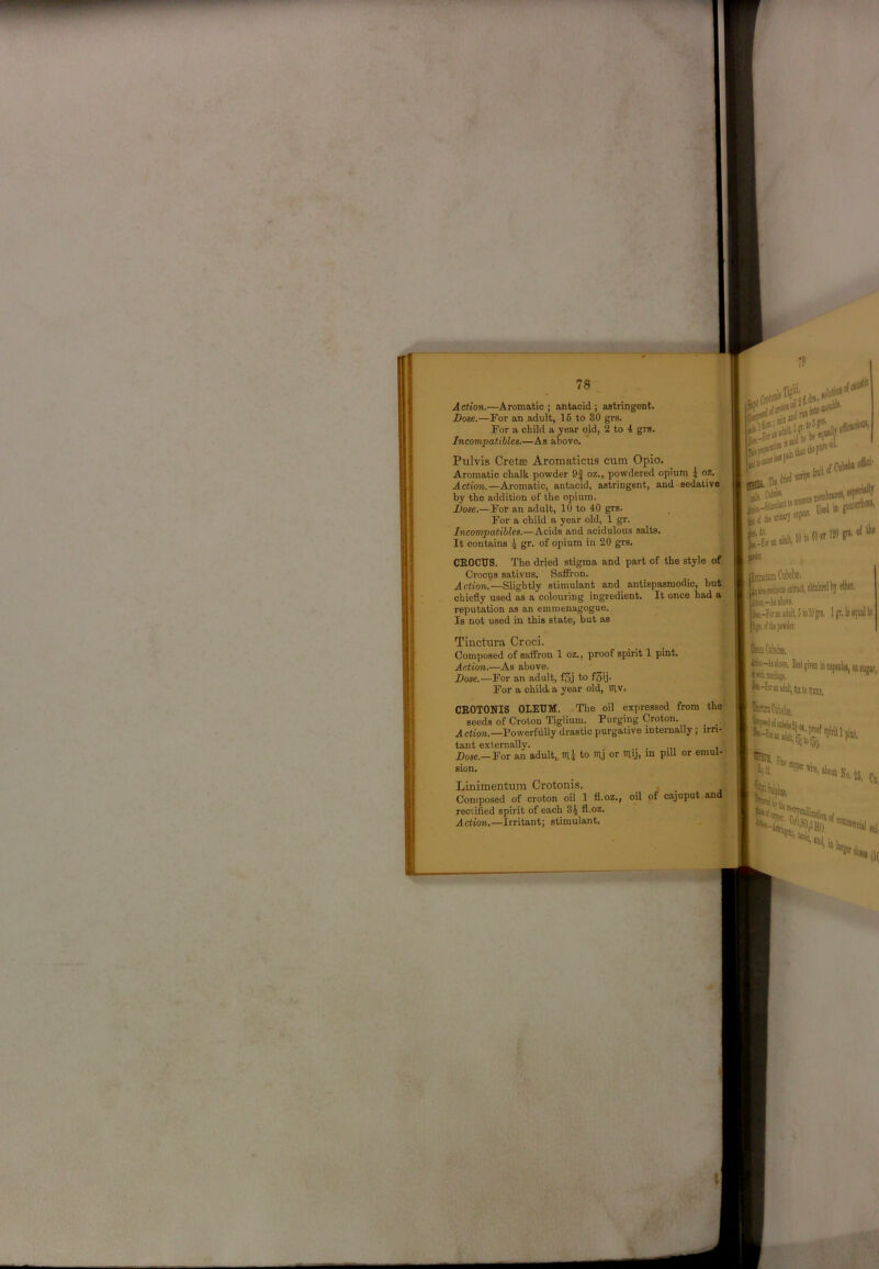 78 Action.—Aromatic ; antacid ; astringent. Dose.—For an adult, 16 to 30 grs. For a child a year old, 2 to 4 grs. Incompatibles.—As above. Ptilvis Crete Aromaticus cum Opio. Aromatic chalk powder 9| oz., powdered opium J oz. Action.—Aromatic, antacid, astringent, and sedative by the addition of the opium. Dose.—For an adult, 10 to 40 grs. For a child a year old, 1 gr. Incompatibles.—Acids and acidulous salts. It contains 4 gr. of opium in 20 grs. CKOCFS. The dried stigma and part of the style of Crocus sativus. Saffron. Action.—Slightly stimulant and antispasmodic, but chiefly used as a colouring ingredient. It once had a reputation as an emmenagogue. Is not used in this state, but as Tinctura Croci. Composed of saffron 1 oz., proof spirit 1 pint. Action.—As above. Dose.—For an adult, f3j to fSij. For a child, a year old, niv. CEOTONIS OLEUM. The oil expressed from the seeds of Croton Tiglium. Purging Croton. _ _ Action.—Powerfully drastic purgative internally ; irri- tant externally. . . , Dose.—For an adult,, mi to mj or my, m pill or emul- Linimentum Crotonis. Composed of croton oil 1 fl.oz., oil of cajuput and rectified spirit of each 34 fl-oz. Action.—Irritant; stimulant. , Cjr.: Til rtn gcto lOlii' u Tin' jlitit .aa Ciiltii!- Iligf felt pte. ejpw»l*y m gononii®*! of tbe liib-rsioE tbore. k.-rotin«iiiIi,iioll)gn. Igr.ii tp.(f;li«pnk OfeiCiliela. lik-luktt, feigireo iocspjiilei, otiujir naaidiH, ^ ’ pint, ^Cnwlie, 111 »t]C| I I m Ilfj S*dcK| (K
