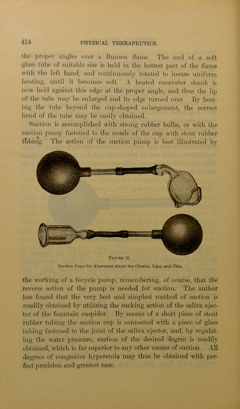 the proper angles over a Bunsen flaine. The end of a soft glass tube of suitable size is held in the hottest part of the flame with the left hand, and continuously rotated to insure uniform heating, until it becomes soft. A heated excavator shank is now held against this edge at the proper angle, and thus the lip of the tube may be enlarged and its edge turned over. By heat- ing the tube beyond the cup-shaped enlargement, the correct bend of the tube may be easily obtained. Suction is accomplished with strong rubber bulbs, or with the suction pump fastened to the nozzle of the cup with stout rubber tubing. The action of the suction pump is best illustrated by Figure 63. Suction Cups for Abscesses about the Cheeks, Lips, and Chin. the working of a bicycle pump, remembering, of course, that the reverse action of the pump is needed for suction. The author has found that the very best and simplest method of suction is readily obtained by utilizing the sucking action of the saliva ejec- tor of the fountain cuspidor. By means of a short piece of stout rubber tubing the suction cup is connected with a piece of glass tubing fastened to the joint of the saliva ejector, and, by regulat- ing the water pressure, suction of the desired degree is readily obtained, which is far superior to any other means of suction. All degrees of congestive hyperemia may thus be obtained with per- fect precision and greatest ease.