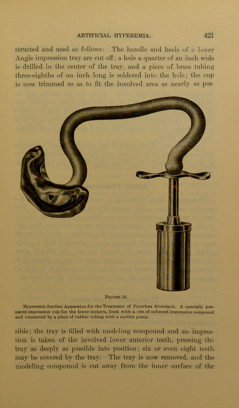 structed and used as follows: The handle and heels of a lower Angle impression tray are cut off; a hole a quarter of an inch wide is drilled in the center of the tray, and a piece of brass tubing three-eighths of an inch long is soldered into the hole; the cup is now trimmed so as to fit the involved area as nearly as pos- Figure 68. Hyperemic Suction Apparatus for the Treatment of Pyorrhea Alveolaris. A specially pre- pared impression cup for the lower incisors, lined with a rim of softened impression compound and connected by a piece of rubber tubing with a suction pump. sible; the tray is filled with modeling compound and an impres- sion is taken of the involved lower anterior teeth, pressing the tray as deeply as possible into position; six or even eight teeth may be covered by the tray. The tray is now removed, and the modeling compound is cut away from the inner surface of the