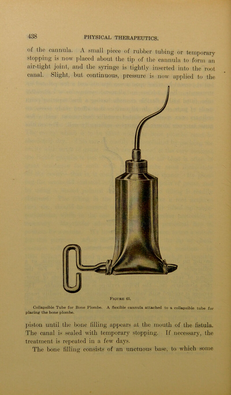 Figure 65. Collapsible Tube for Bone Plombe. A flexible cannula attached to a collapsible tube for placing the bone plombe. jnston until the bone filling appears at the mouth of the fistula. The canal is sealed with temporary stopping. If necessary, the treatment is repeated in a few days. The bone filling consists of an unctuous base, to which some 438 PHYSICAL THERAPEUTICS. of the cannula. A small piece of rubber tubing or temporary stopping is now iilaced about the tip of the cannula to form an air-tight joint, and the syringe is tightly inserted into the root canal. Slight, but continuous, pressure is now applied to the