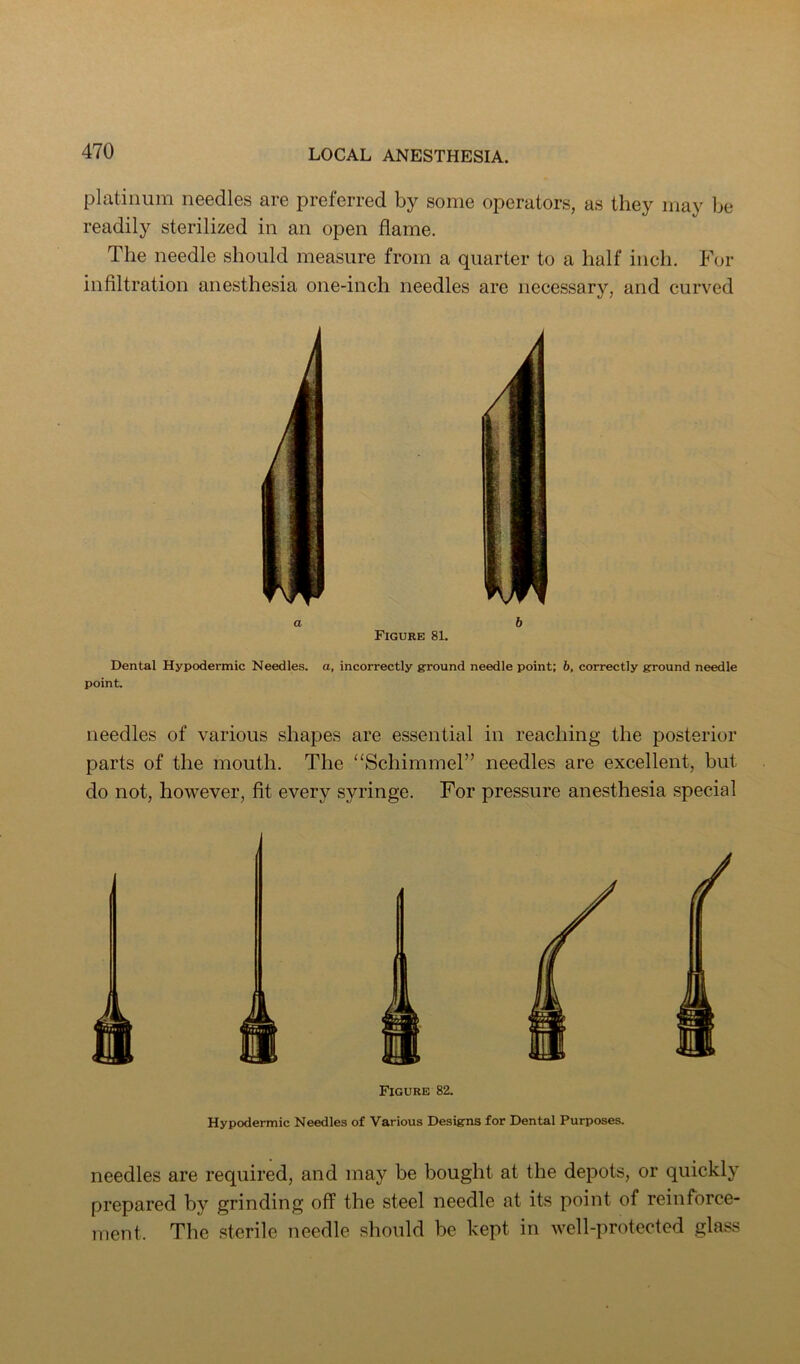 platinum needles are preferred by some operators, as they may be readily sterilized in an open flame. The needle should measure from a quarter to a half inch. For infiltration anesthesia one-inch needles are necessary, and curved a b Figure 81. Dental Hypodermic Needles, a, incorrectly ground needle point: b, correctly ground needle point. needles of various shapes are essential in reaching the posterior parts of the mouth. The “Schimmel” needles are excellent, but do not, however, fit every syringe. For pressure anesthesia special Figure 82. Hypodermic Needles of Various Designs for Dental Purposes. needles are required, and may be bought at the depots, or quickly prepared by grinding off the steel needle at its point of reinforce- ment. The sterile needle should be kept in well-protected glass