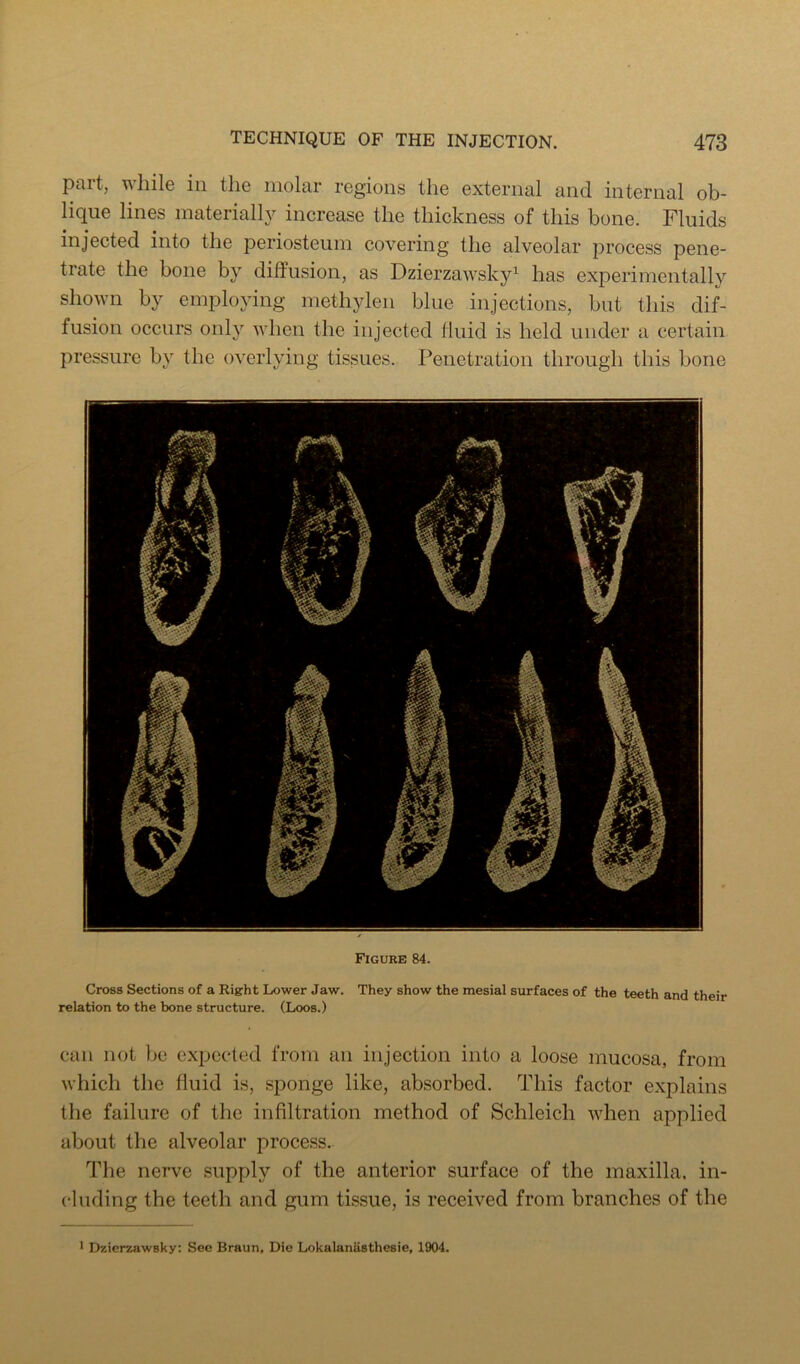 part, while in the molar regions the external and internal ob- lique lines materially increase the thickness of this bone. Fluids injected into the periosteum covering the alveolar process pene- trate the bone by diffusion, as Dzierzawsky^ has experimentally shown by employing methylen blue injections, but this dif- fusion occurs only when the injected fluid is held under a certain pressure by the overlying tissues. Penetration through this bone Figure 84. Cross Sections of a Right Lower Jaw. They show the mesial surfaces of the teeth and their relation to the bone structure. (Loos.) can not be expected from an injection into a loose mucosa, from which the fluid is, .sponge like, absorbed. This factor explains the failure of the infiltration method of Schleich when applied about the alveolar process. The nerve supply of the anterior surface of the maxilla, in- cluding the teeth and gum tissue, is received from branches of the ■ Dzierzawsky: See Braun, Die Lokalaniisthesie, 1904.