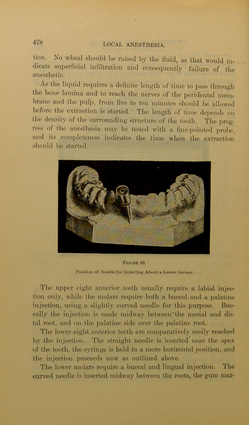 tioii. No wheal should be raised by the fluid, as that would in- dicate superficial infiltration and consequently failure of the anesthetic. As the liquid requires a definite length of time to pass through the bone lamina and to reach the nerves of the peridental mem- brane and the pulp, from five to ten minutes should be allowed before the extraction is started. The length of time depends on the density of the surrounding structure of the tooth. The prog- ress of the anesthesia may be tested with a fine-pointed probe, and its completeness indicates the time when the extraction should be started. Figure 89. Position of Needle for Injecting- About a Lo-wer Incisor. The upper eight anterior teeth usually require a labial injec- tion only, while the molars require both a buccal and a palatine injection, using a slightly curved needle for this purpose. Biic- cally the injection is made midway between*the mesial and dis- tal root, and on the palatine side over the palatine root. The lower eight anterior teeth are comparatively ea.'^ily reached by the injection. The straight needle is inserted near the apex of the tooth, the syringe is held in a more horizontal jiosition, and the injection proceeds now as outlined above. The lower molars require a buccal and lingual injection. The curved needle is inserted midway between the roots, the gum mar-