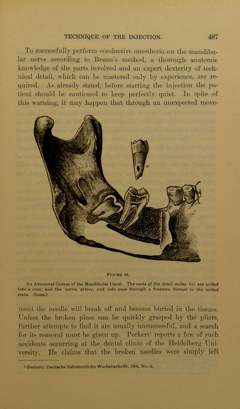 Figure 94. An Abnormal Course of the Mandibular Canal. The roots of the third molar (a) are united into a cone, and the nerve, artery, and vein pass through a foramen formed in the united roots. (Loos.) ineiit the needle will break off and become buried in the tissues. Unless the broken piece can be quickly grasped by the pliers, further attempts to find it are usually unsuccessful, and a search for its removal must be given up. Peckert^ reports a few of such accidents occurring at the dental clinic of the Heidelberg Uni- versity. He claims that the broken needles were simply left TECHNIQUE OF THE INJECTION. 487 To successfully perform conductive anesthesia on the mandibu- lar nerve according to Braun’s method, a thorough anatomic knowledge of the parts involved and an expert dexterity of tech- nical detail, which can be mastered only by experience, are re- quired. As already stated, before starting the injection the pa- tient should be cautioned to keep perfectly quiet. In spite of this warning, it may happen that through an unexpected move-