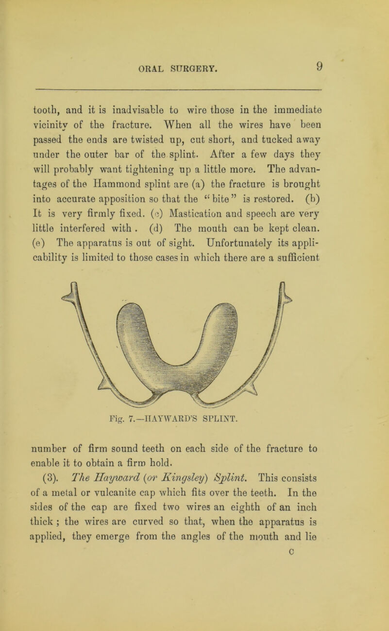 tooth, and it is inadvisable to wire those in the immediate vicinitv of the fracture. When all the wires have been •j passed the ends are twisted up, cut short, and tucked away under the outer bar of the splint. After a few days they will probably want tightening up a little more. Tho advan- tages of the Hammond splint are (a) the fracture is brought into accurate apposition so that the “bite” is restored, (b) It is very firmly fixed, (c) Mastication and speech are very little interfered with . (d) The mouth can be kept clean, (e) The apparatus is out of sight. Unfortunately its appli- cability is limited to those cases in which there are a sufficient number of firm sound teeth on each side of the fracture to enable it to obtain a firm hold. (3). The Hayward (or Kingsley) Splint. This consists of a metal or vulcanite cap which fits over the teeth. In the sides of the cap are fixed two wires an eighth of an inch thick ; the wires are curved so that, when the apparatus is applied, they emerge from the angles of the mouth and lie c