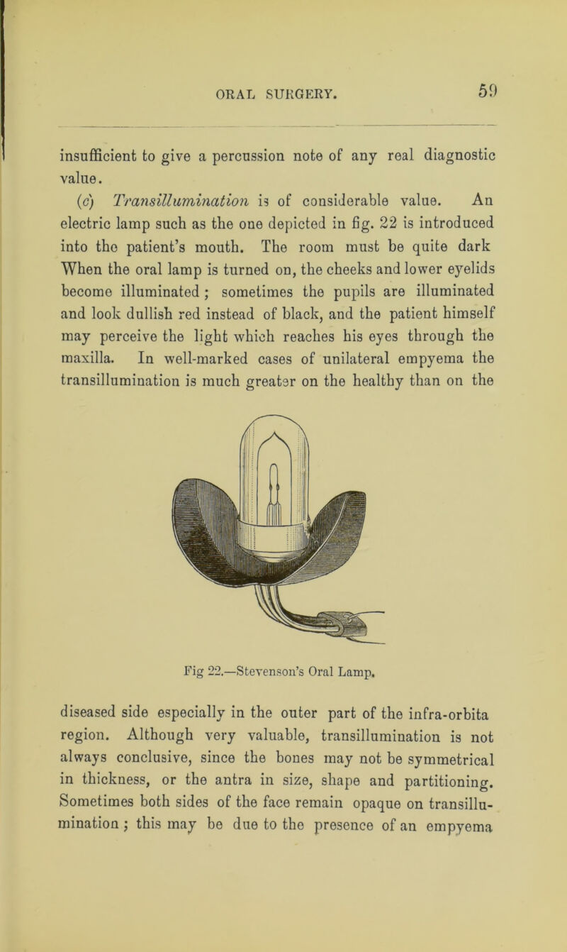 insufficient to give a percussion note of any real diagnostic value. (c) Transillumination is of considerable value. An electric lamp such as the one depicted in fig. 22 is introduced into the patient’s mouth. The room must be quite dark When the oral lamp is turned on, the cheeks and lower eyelids become illuminated ; sometimes the pupils are illuminated and look dullish red instead of black, and the patient himself may perceive the light which reaches his eyes through the maxilla. In well-marked cases of unilateral empyema the transillumination is much greater on the healthy than on the Fig 22.—Stevenson’s Oral Lamp. diseased side especially in the outer part of the infra-orbita region. Although very valuable, transillumination is not always conclusive, since the bones may not be symmetrical in thickness, or the antra in size, shape and partitioning. Sometimes both sides of the face remain opaque on transillu- mination ; this may be due to tho presence of an empyema