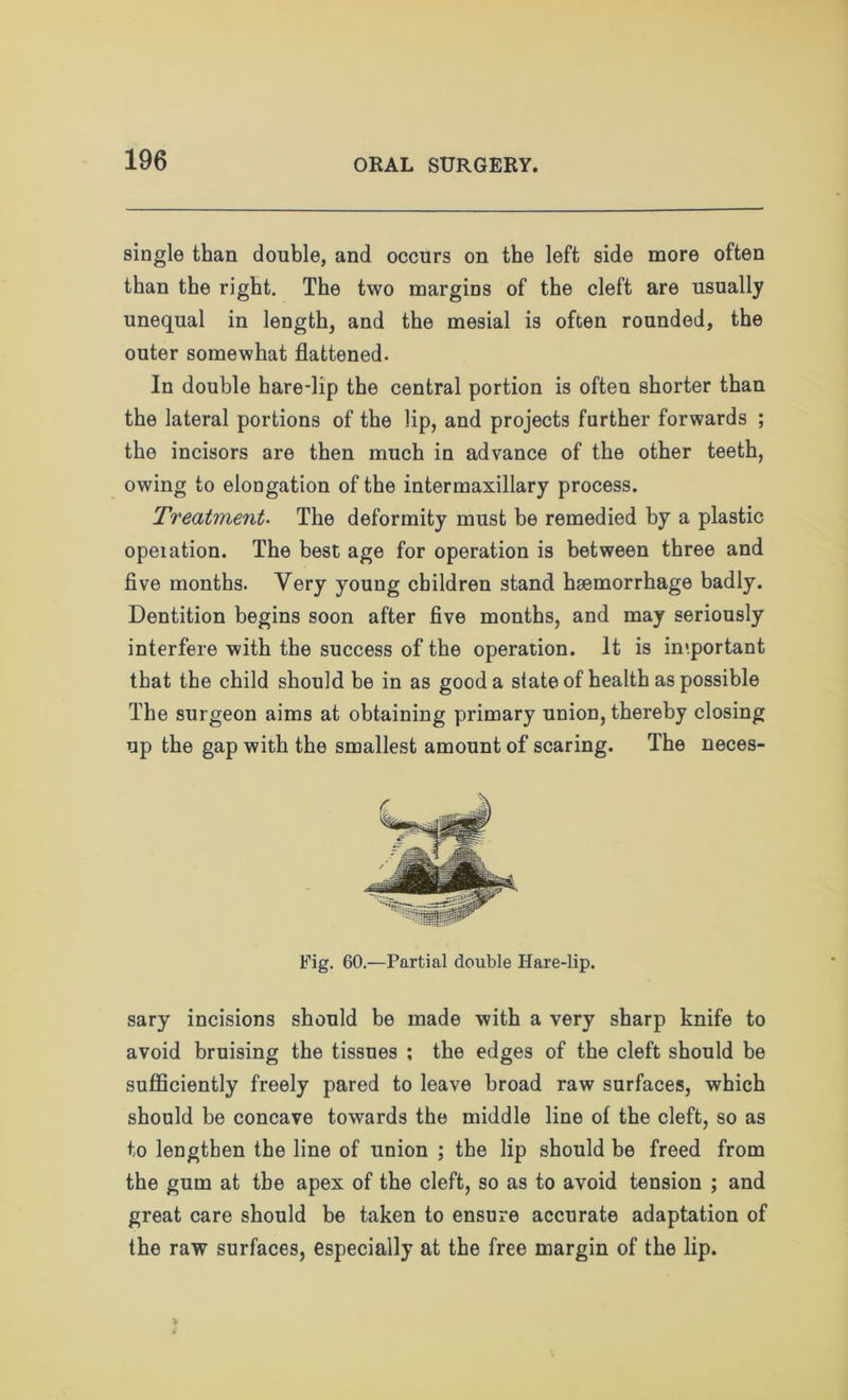 single than double, and occurs on the left side more often than the right. The two margins of the cleft are usually unequal in length, and the mesial is often rounded, the outer somewhat flattened. In double hare-lip the central portion is often shorter than the lateral portions of the lip, and projects further forwards ; the incisors are then much in advance of the other teeth, owing to elongation of the intermaxillary process. Treatment. The deformity must be remedied by a plastic opeiation. The best age for operation is between three and five months. Very young children stand haemorrhage badly. Dentition begins soon after five months, and may seriously interfere with the success of the operation. It is important that the child should be in as good a state of health as possible The surgeon aims at obtaining primary union, thereby closing up the gap with the smallest amount of scaring. The neces- Fig. 60.—Partial double Hare-lip. sary incisions should be made with a very sharp knife to avoid bruising the tissues ; the edges of the cleft should be sufficiently freely pared to leave broad raw surfaces, which should be concave towards the middle line of the cleft, so as to lengthen the line of union ; the lip should be freed from the gum at the apex of the cleft, so as to avoid tension ; and great care should be taken to ensure accurate adaptation of the raw surfaces, especially at the free margin of the lip.