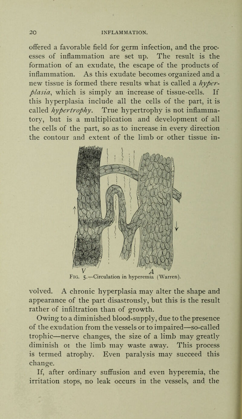 offered a favorable field for germ infection, and the proc- esses of inflammation are set up. The result is the formation of an exudate, the escape of the products of inflammation. As this exudate becomes organized and a new tissue is formed there results what is called a hyper- plasia^ which is simply an increase of tissue-cells. If this hyperplasia include all the cells of the part, it is called hypertrophy. True hypertrophy is not inflamma- tory, but is a multiplication and development of all the cells of the part, so as to increase in every direction the contour and extent of the limb or other tissue in- Fig. 5.—Circulation in hyperemia (Warren). volved. A chronic hyperplasia may alter the shape and appearance of the part disastrously, but this is the result rather of infiltration than of growth. Owing to a diminished blood-supply, due to the presence of the exudation from the vessels or to impaired—so-called trophic—nerve changes, the size of a limb may greatl}^ diminish 01 the limb may waste away. This process is termed atrophy. Even paralysis may succeed this change. If, after ordinary suffusion and even hyperemia, the irritation stops, no leak occurs in the vessels, and the