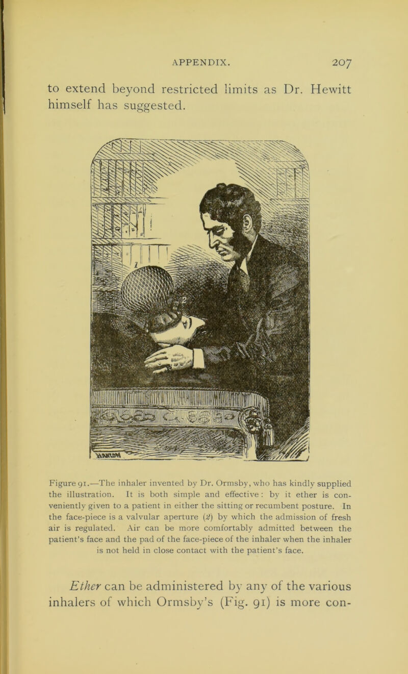 to extend beyond restricted limits as Dr. Hewitt himself has suggested. Figure 91.—The inhaler invented by Dr. Ormsby, who has kindly supplied the illustration. It is both simple and effective : by it ether is con- veniently given to a patient in either the sitting or recumbent posture. In the face-piece is a valvular aperture (2) by which the admission of fresh air is regulated. Air can be more comfortably admitted between the patient’s face and the pad of the face-piece of the inhaler when the inhaler is not held in close contact with the patient’s face. Ether can be administered by any of the various inhalers of which Ormsby’s (Fig. 91) is more con-