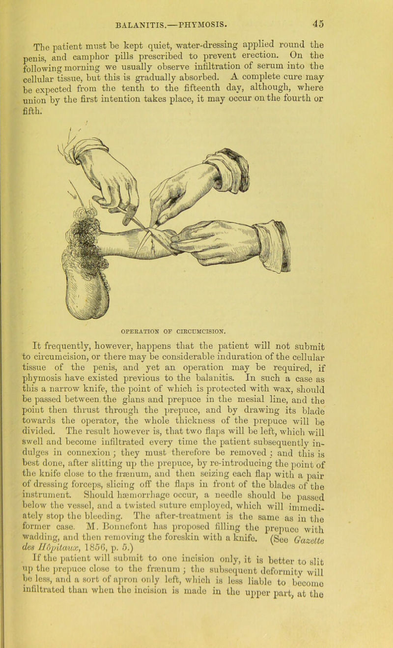 The patient must be kept quiet, water-dressing applied round the penis, and camphor pills prescribed to prevent erection. On the following morning we usually observe infiltration of serum into the cellular tissue, but this is gradually absorbed. A complete cure may be expected from the tenth to the fifteenth day, although, where union by the first intention takes place, it may occur on the fourth or fifth. OPERATION OF CIRCUMCISION. It frequently, however, happens that the patient will not submit to circumcision, or there may be considerable induration of the cellular tissue of the penis, and yet an operation may be required, if phymosis have existed previous to the balanitis. In such a case as this a narrow knife, the point of which is protected with wax, should be passed between the glans and prepuce in the mesial line, and the point then thrust through the prepuce, and by drawing its blade towards the operator, the whole thickness of the prepuce will be divided. The result however is, that two flaps will be left, which will swell and become infiltrated every time the patient subsequently in- dulges in connexion; they must therefore be removed ; and this is best done, after slitting up the prepuce, by re-introducing the point of the knife close to the fnenum, and then seizing each flap with a pair of dressing forceps, slicing off the flaps in front of the blades of the instrument. Should haemorrhage occur, a needle should be passed below the vessel, and a twisted suture employed, which will immedi- ately stop the bleeding. The after-treatment is the same as in the former case. M. Bounefont has proposed filling the prepuce with wadding, and then removing the foreskin with a knife. (See Gazette dee Ildpitcmx, 1856, p. 5.) If the patient will submit to one incision only, it is better to slit up the prepuce close to the fnenum ; the subsequent deformity will bo less, and a sort of apron only left, which is less liable to become infiltrated than when the incision is made in the upper part, at the