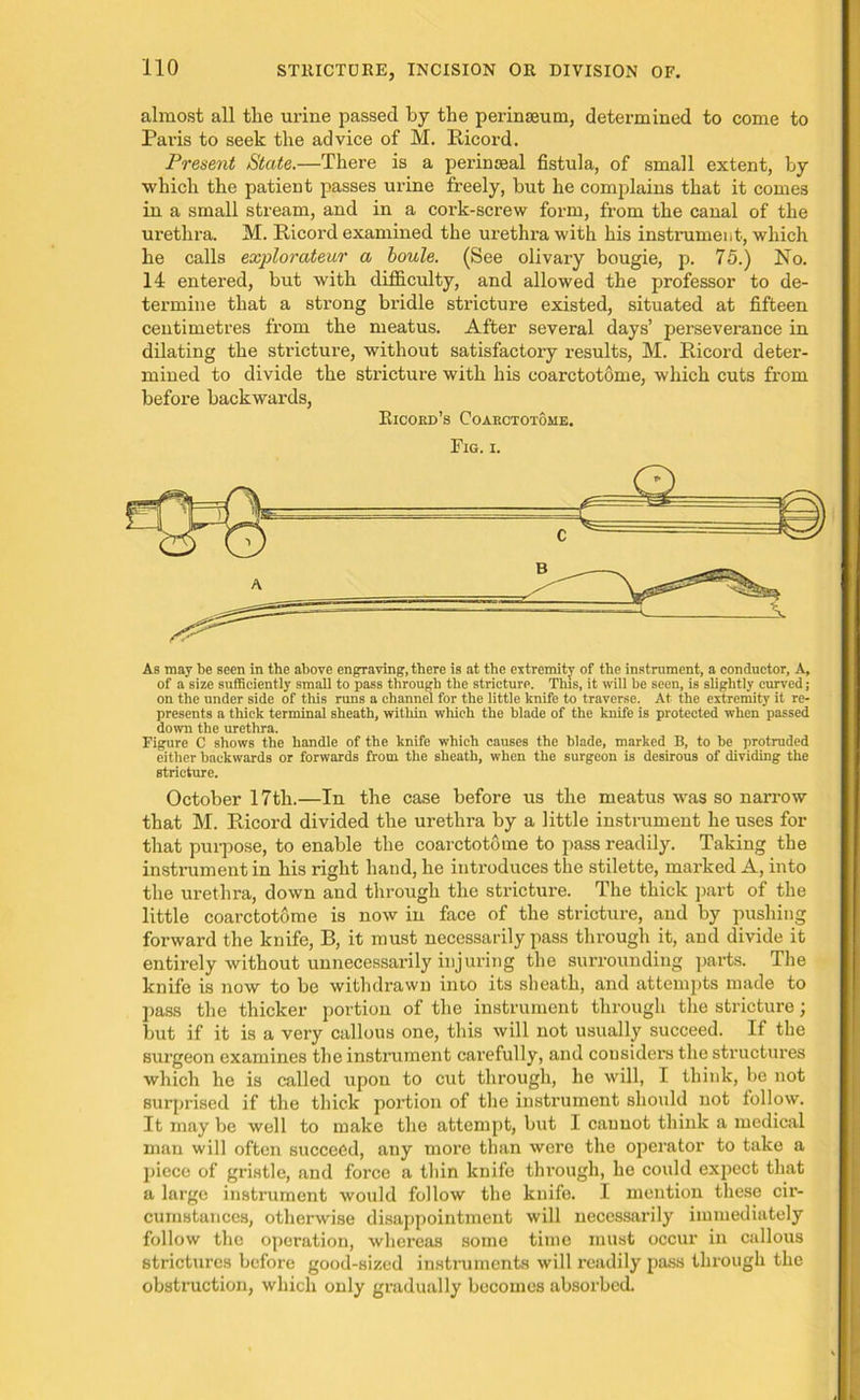 almost all the urine passed by the perinseum, determined to come to Pai'is to seek the advice of M. Ricord. Present State.—There is a perinoeal fistula, of small extent, by which the patient passes urine freely, but he complains that it comes in a small stream, and in a cork-screw form, from the canal of the urethra. M. Ricord examined the urethra with his instrument, which he calls explorateur a boule. (See olivary bougie, p. 75.) No. 14 entered, but with difficulty, and allowed the professor to de- termine that a strong bridle stricture existed, situated at fifteen centimetres from the meatus. After several days’ perseverance in dilating the stricture, without satisfactory results, M. Ricord deter- mined to divide the stricture with his coarctotome, which cuts from before backwards, Ricoed’s Coarctotome. Fig. i. As may be seen in the above engraving, there is at the extremity of the instrument, a conductor. A, of a size sufficiently small to pass through the stricture. This, it will be seen, is slightly curved; on the under side of this runs a channel for the little knife to traverse. At the extremity it re- presents a thick terminal sheath, within which the blade of the knife is protected when passed down the urethra. Figure C shows the handle of the knife which causes the blade, marked B, to be protruded either backwards or forwards from the sheath, when the surgeon is desirous of dividing the stricture. October 17th.—In the case before us the meatus was so narrow that M. Ricord divided the urethra by a little instrument he uses for that purpose, to enable the coarctotome to pass readily. Taking the instrument in his right hand, he introduces the stilette, marked A, into the urethra, down and through the stricture. The thick part of the little coarctotome is now in face of the stricture, and by pushing forward the knife, B, it must necessarily pass through it, and divide it entirely without unnecessarily injuring the surrounding parts. The knife is now to be withdrawn into its sheath, and attempts made to pass the thicker portion of the instrument through the stricture; but if it is a very callous one, this will not usually succeed. If the surgeon examines the instrument carefully, and considers the structures which he is called upon to cut through, he will, I think, be not surprised if the thick portion of the instrument should not follow. It may be well to make the attempt, but I cannot think a medical man will often succeed, any more than were the operator to take a piece of gristle, and force a thin knife through, he could expect that a large instrument would follow the knife. I mention these cir- cumstances, otherwise disappointment will necessarily immediately follow the operation, whereas some time must occur in callous strictures before good-sized instruments will readily pass through the obstruction, which only gradually becomes absorbed.