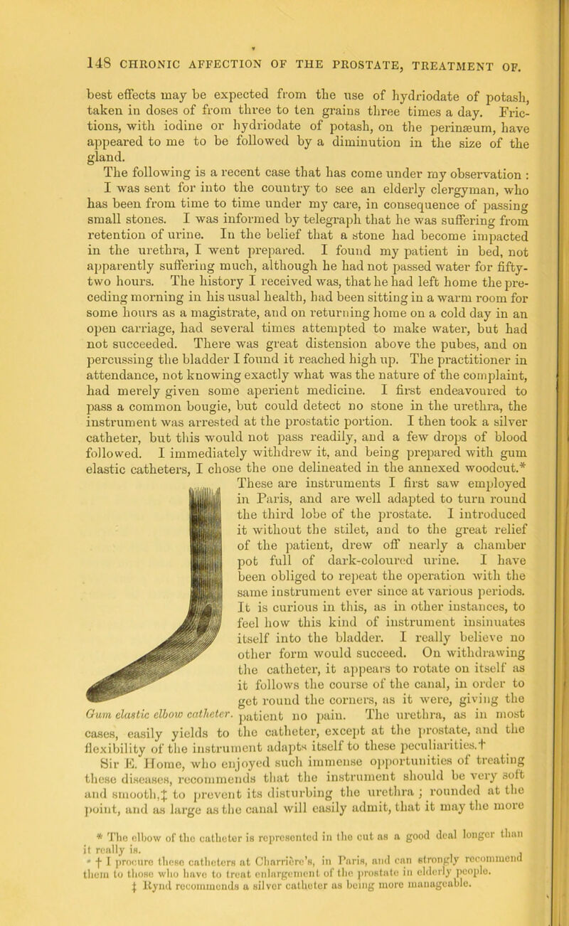 best effects may be expected from the use of hydriodate of potash, taken in doses of from three to ten grains three times a day. Fric- tions, with iodine or hydriodate of potash, on the perinseum, have appeared to me to be followed by a diminution in the size of the gland. The following is a recent case that has come under my observation : I was sent for into the country to see an elderly clergyman, who has been from time to time under my care, in consequence of passing small stones. I was informed by telegraph that he was suffering from retention of urine. In the belief that a stone had become impacted in the urethra, I went prepared. I found my patient in bed, not apparently suffering much, although he had not passed water for fifty- two hours. The history I received was, that he had left home the pre- ceding morning in his usual health, had been sitting in a warm room for some hours as a magistrate, and on returning home on a cold day in an open carriage, had several times attempted to make water, but had not succeeded. There was great distension above the pubes, and on percussing the bladder I found it reached high up. The practitioner in attendance, not knowing exactly what was the nature of the complaint, had merely given some aperient medicine. I first endeavoured to pass a common bougie, but could detect no stone in the urethra, the instrument was arrested at the prostatic portion. I then took a silver catheter, but this would not pass readily, and a few drops of blood followed. I immediately withdrew it, and beiDg prepared with gum elastic catheters, I chose the one delineated in the annexed woodcut.* These are instruments I first saw employed in Paris, and are well adapted to turn round the third lobe of the prostate. I introduced it without the stilet, and to the great relief of the patient, drew off nearly a chamber pot full of dark-coloured urine. I have been obliged to repeat the operation with the same instrument ever since at various periods. It is curious in this, as in other instances, to feel how this kind of instrument insinuates itself into the bladder. I really believe no other form would succeed. On withdrawing the catheter, it appears to rotate on itself as it follows the course of the canal, in order to get round the corners, as it were, giving the Gum elastic elbow catheter. j)atient no pain. The urethra, as in most cases, easily yields to the catheter, except at the prostate, and the flexibility of the instrument adapts itself to these jieculiarities.l Sir E. Home, who enjoyed such immense opportunities of treating these diseases, recommends that the instrument should be very soft and smooth,J to prevent its disturbing the urethra j rounded at the point, and as large as the canal will easily admit, that it may the more * The elbow of the catheter is represented in the cut as a good deal longer than it really is. , * f I procure these catheters at Charriere’s, in Paris, and can strongly recommend them to those who have to treat enlargement of the prostate in elderly people, f Rynd recommends a silver catheter as being more manageable.
