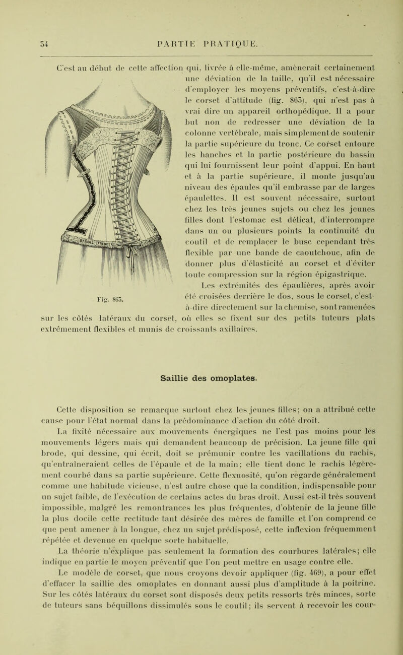 C'est au début de cette affection qui, livrée à elle-même, amènerait certainement une déviation de la taille, qu'il est nécessaire d’employer les moyens préventifs, c’est-à-dire le corset d’attitude (fig. 8G5), qui n’est pas à vrai dire un appareil orthopédique. Il a pour but non de redresser une déviation de la colonne vertébrale, mais simplement de soutenir la partie supérieure du tronc. Ce corset entoure les hanches et la partie postérieure du bassin qui lui fournissent leur point d’appui. En haut et à la partie supérieure, il monte jusqu’au niveau des épaules qu’il embrasse par de larges épaulettes. 11 est souvent nécessaire, surtout chez les très jeunes sujets ou chez les jeunes tilles dont l'estomac est délicat, d’interrompre dans un ou plusieurs points la continuité du coutil et de remplacer le buse cependant très flexible par une bande de caoutchouc, afin de donner plus d’élasticité au corset et d’éviter toute compression sur la région épigastrique. Les extrémités des épaulières, après avoir été croisées derrière le dos, sous le corset, c’est- à-dire directement sur la chemise, sont ramenées sur les côtés latéraux du corset, où elles se fixent sur des petits tuteurs plats extrêmement flexibles et munis de croissants axillaires. Saillie des omoplates. Cette disposition se remarque surtout chez les jeunes tilles; on a attribué cette cause pour l'état normal dans la prédominance d'action du côté droit. La fixité nécessaire aux mouvements énergiques 11e l’est pas moins pour les mouvements légers mais qui demandent beaucoup de précision. La jeune fille qui brode, qui dessine, qui écrit, doit se prémunir contre les vacillations du rachis, qu’entraîneraient celles de l’épaule et de la main; elle tient donc le rachis légère- ment courbé dans sa partie supérieure. Celle flexuosité, qu’on regarde généralement comme une habitude vicieuse, n'est autre chose que la condition, indispensable pour un sujet faible, de l’exécution de certains actes du bras droit. Aussi est-il très souvent impossible, malgré les remontrances les plus fréquentes, d’obtenir de la jeune fille la plus docile cette rectitude tant désirée des mères de famille et l'on comprend ce que peut amener à la longue, chez un sujet prédisposé, cette inflexion fréquemment répétée et devenue en quelque sorte habituelle. La théorie n’explique pas seulement la formation des courbures latérales; elle indique en partie le moyen préventif que l'on peut mettre en usage contre elle. Le modèle de corset, que nous croyons devoir appliquer (fig. 409), a pour effet d'effacer la saillie des omoplates en donnant aussi plus d’amplitude à la poitrine. Sur les côtés latéraux du corset sont disposés deux petits ressorts très minces, sorte de tuteurs sans béquillons dissimulés sous le coutil; ils servent à recevoir les cour-