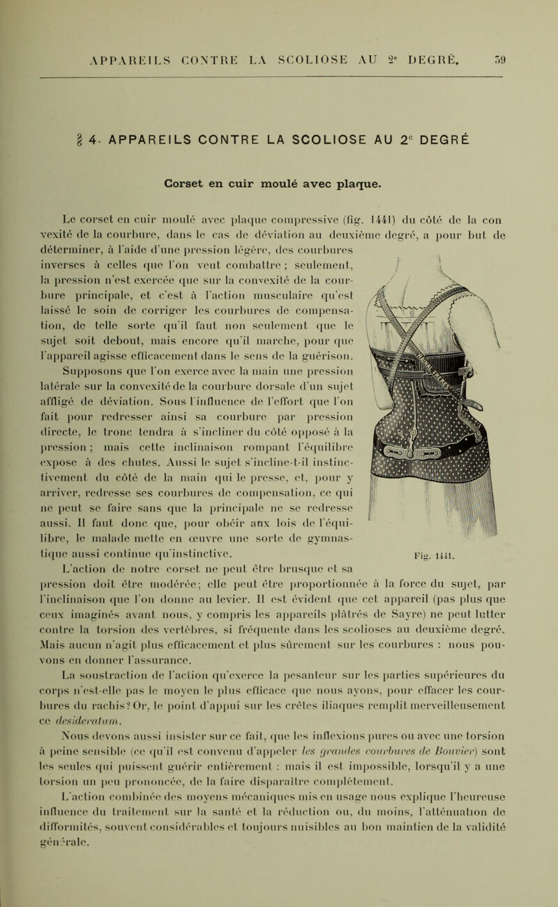 4- APPAREILS CONTRE LA SCOLIOSE AU 2e DEGRÉ Corset en cuir moulé avec plaque. Le corset en cuir moulé avec plaque compressive (fig. 1441) du côté de la con vexité de la courbure, dans le cas de déviation au deuxième degré, a pour but de déterminer, à l'aide d'une pression légère, des courbures inverses à celles que l'on veut combattre; seulement, la pression n'est exercée que sur la convexité de la cour- bure principale, et c'est à l'action musculaire qu'est laissé le soin de corriger les courbures de compensa- tion, de telle solde qu'il faut non seulement que le sujet soit debout, mais encore qu'il marche, pour que l'appareil agisse efficacement dans le sens de la guérison. Supposons que l'on exerce avec la main une pression latérale sur la convexité de la courbure dorsale d'un sujet affligé de déviation. Sous l'influence de l’effort que l’on fait pour redresser ainsi sa courbure par pression directe, le tronc tendra à s'incliner du côté opposé à la pression ; mais cette inclinaison rompant l'équilibre expose à des chutes. Aussi le sujet s'incline-t-il instinc- tivement du côté de la main qui le presse, et, pour y arriver, redresse ses courbures de compensation, ce qui ne peut se faire sans que la principale ne se redresse aussi. 11 faut donc que, pour obéir aux lois de l'équi- libre, le malade mette en œuvre une sorte de gymnas- tique aussi continue qu'instinctive. Fig. un. L'action de notre corset ne peut être brusque et sa pression doit être modérée; elle peut être proportionnée à la force du sujet, par l'inclinaison que l'on donne au levier. Il est évident que cet appareil (pas plus que ceux imaginés avant nous, y compris les appareils plâtrés de Sayre) ne peut lutter contre la torsion des vertèbres, si fréquente dans les scolioses au deuxième degré. Mais aucun n'agit, plus efficacement et plus sûrement sur les courbures : nous pou- vons en donner l'assurance. La soustraction de l’action qu’exerce la pesanteur sur les parties supérieures du corps n'est-elle pas le moyen le plus efficace que nous ayons, pour effacer les cour- bures du rachis? Or, le point d’appui sur les crêtes iliaques remplit merveilleusement ce desideratum. Nous devons aussi insister sur ce fait, que les inflexions pures ou avec une torsion à peine sensible (ce qu'il est convenu d’appeler les grandes courbures de Bouvier) sont les seules qui puissent guérir entièrement : mais il est impossible, lorsqu’il y a une torsion un peu prononcée, de la faire disparaître complètement. L'action combinée des moyens mécaniques mis en usage nous explique l'heureuse influence du traitement sur la santé et la réduction ou, du moins, l’atténuation de difformités, souvent considérables et toujours nuisibles au bon maintien de la validité générale.