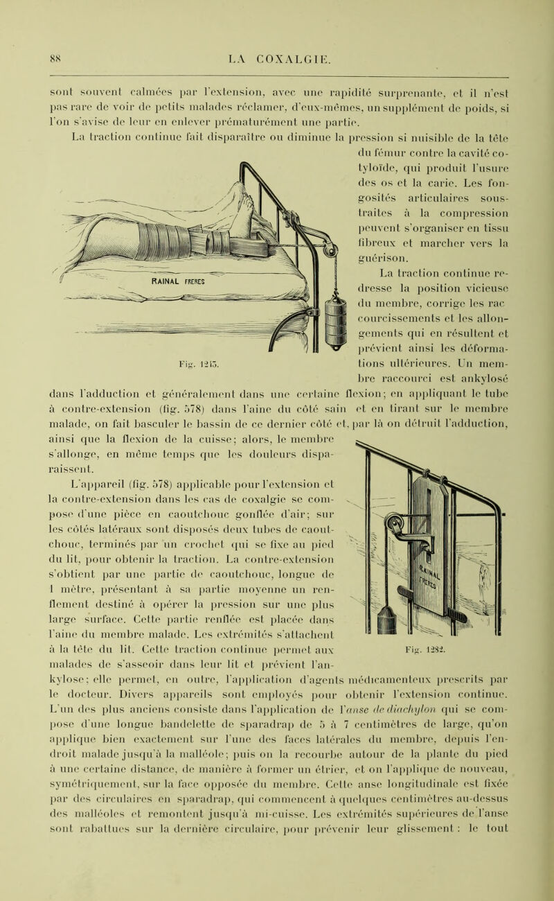 sont souvent calmées par l’extension, avec une rapidité surprenante, et il n'est pas rare de voir de petits malades réclamer, d’eux-mêmes, un supplément de poids, si l’on s'avise de leur en enlever prématurément une partie. La traction continue fait disparaître ou diminue la pression si nuisible de la tête du fémur contre la cavité co- tyloïde, qui produit l'usure des os et la carie. Les fon- gosités articulaires sous- traites à la compression peuvent s’organiser en tissu fibreux et marcher vers la guérison. La traction continue re- dresse la position vicieuse du membre, corrige les rac courcissements et les allon- gements qui en résultent et prévient ainsi les déforma- tions ultérieures. Un mem- bre raccourci est ankylosé dans l’adduction et généralement dans une certaine flexion; en appliquant le tube à contre-extension (fig. 578) dans l'aine du côté sain et en tirant sur le membre malade, on fait basculer le bassin de ce dernier côté et, par là on détruit l’adduction, ainsi que la flexion de la cuisse; alors, le membre s'allonge, en même temps que les douleurs dispa- raissent. L’appareil (fig. 578) applicable pour l’extension et la contre-extension dans les cas de coxalgie se com- pose d’une pièce en caoutchouc gonflée d’air; sui- tes côtés latéraux sont disposés deux tubes de caout- chouc, terminés par un crochet qui se fixe au pied du lit, pour obtenir la traction. La contre-extension s'obtient par une partie de caoutchouc, longue de 1 mètre, présentant à sa partie moyenne un ren- flement destiné à opérer la pression sur une plus large surface. Cette partie renflée est placée dans l’aine du membre malade. Les extrémités s’attachent à la tête du lit. Cette traction continue permet aux malades de s’asseoir dans leur liL et prévient l’an- kylose; elle permet, en outre, l’application d’agents médicamenteux prescrits par le docteur. Divers appareils sont employés pour obtenir l’extension continue. L'un des plns anciens consiste dans l’application de l’anse de diachylon qui se com- pose d’une longue bandelette de sparadrap de 5 à 7 centimètres de large, qu’on applique bien exactement sur l’une des faces latérales du membre, depuis l’en- droit malade jusqu’à la malléole; puis on la recourbe autour de la plante du pied à une certaine distance, de manière à former un étrier, et on l’applique de nouveau, symétriquement, sur la face opposée du membre. Cette anse longitudinale est fixée par des circulaires en sparadrap, qui commencent à quelques centimètres au-dessus des malléoles et remontent jusqu’à mi-cuisse. Les extrémités supérieures de l'anse sont rabattues sur la dernière circulaire, pour prévenir leur glissement : le tout