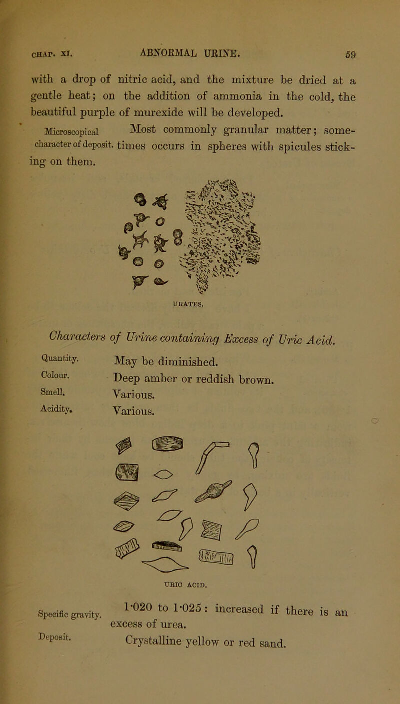 with a drop of nitric acid, and the mixture be dried at a gentle heat; on the addition of ammonia in the cold, the beautiful purple of murexide will be developed. Microscopical Most commonly granular matter; some- character of deposit, times occurs in spheres with spicules stick- ing on them. URATES. Characters of Urine containing Excess of Uric Acid. Quantity. Colour. Smell. Acidity. May be diminished. Deep amber or reddish brown. Various. Various. XJRIO ACID. Specific gravity. Deposit. 1 020 to 1’025 : increased if there is an excess of urea. Crystalline yellow or red sand.