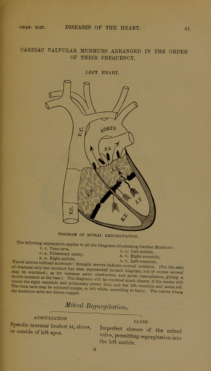 CARDIAC VALVULAR MURMURS ARRANGED IN THE ORDER OF THEIR FREQUENCY. LEFT HEART. diagbam of mitbal begubgitation. The fonowingexpmnationapplies to all the Diagrams illustrating Cardiac Murmurs : p. A. Pulmonary artery. t' £ef|\auricle- R. a. Right auricle. . 1' flght ventlicle. ESSSSTSSE St™VndiCate“ ^rthesake may he combined; as ^ course several double murmur at the base.) The diagrams wilt^rendereTm^^'* ™gurgitaiion' ^ivin& a colour the right ventricle and pulmonary artery Wue an l lTffr ’ if th° rea<ler wiU The vena cava may be coloured purple or left white ’ ^ left ventncle and aorta red. the murmurs arise are drawn rugged ’ to faa°r- The valves where Mitral Regurgitation. AUSCULTATION Q CAUSE Systolic murmur loudest at, above, Imperfect or outside of left apex P ®Ct closure of the mitral P ' T1lllve’ Permitting regurgitation into the left am-icle.