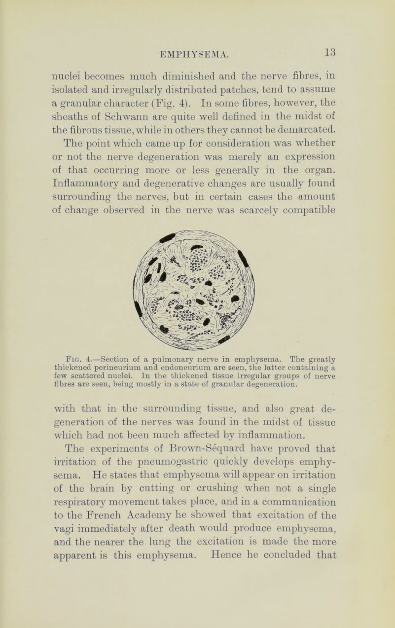 nuclei becomes much diminished and the nerve fibres, in isolated and irregularly distributed patches, tend to assume a granular character (Fig. 4). In some fibres, however, the sheaths of Schwann are quite well defined in the midst of the fibrous tissue, while in others they cannot be demarcated. The point which came up for consideration was whether or not the nerve degeneration was merely an expression of that occurring more or less generally in the organ. Inflammatory and degenerative changes are usually found surrounding the nerves, but in certain cases the amount of change observed in the nerve was scarcely compatible Fig. 4.—Section of a pulmonary nerve in emphysema. The greatly thickened perineurium and endoneurium are seen, the latter containing a few scattered nuclei. In the thickened tissue irregular groups of nerve fibres are seen, being mostly in a state of granular degeneration. with that in the surrounding tissue, and also great de- generation of the nerves was found in the midst of tissue which had not been much affected by inflammation. The experiments of Brown-Sequard have proved that irritation of the pneumogastric quickly develops emphy- sema. He states that emphysema will appear on irritation of the brain by cutting or crushing when not a single respiratory movement takes place, and in a communication to the French Academy he showed that excitation of the vagi immediately after death would produce emphysema, and the nearer the lung the excitation is made the more apparent is this emphysema. Hence he concluded that