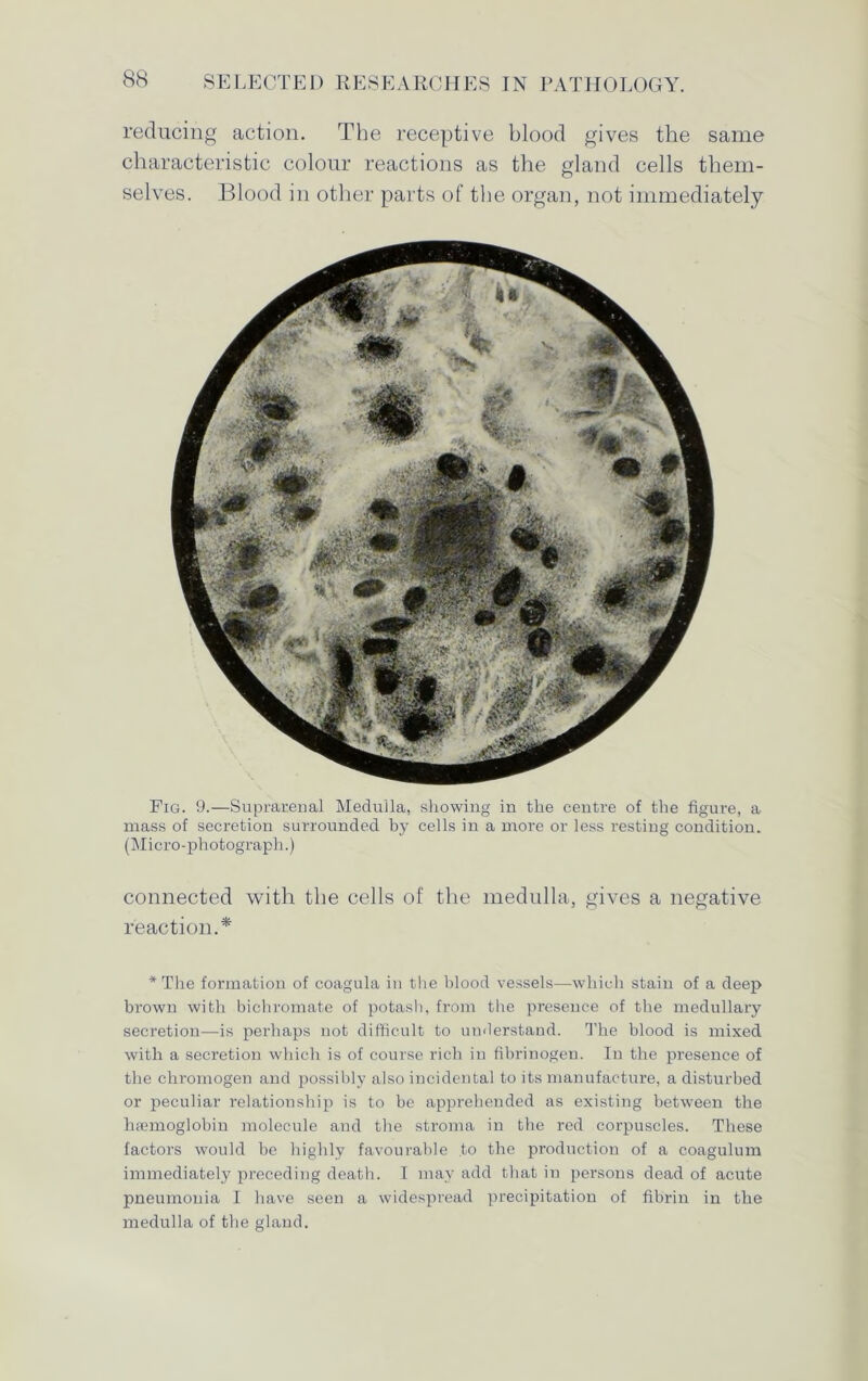 reducing action. The receptive blood gives the same characteristic colour reactions as the gland cells them- selves. Blood in other parts of the organ, not immediately Fig. 9.—Suprarenal Medulla, showing in the centre of the figure, a mass of secretion surrounded by cells in a more or less resting condition. (Micro-photograph.) connected with the cells of the medulla, gives a negative reaction.* * The formation of coagula in the blood vessels—which stain of a deep brown with bichromate of potash, from the presence of the medullary secretion—is perhaps not difficult to understand. The blood is mixed with a secretion which is of course rich in fibrinogen. In the presence of the chromogen and possibly also incidental to its manufacture, a disturbed or peculiar relationship is to be apprehended as existing between the haemoglobin molecule and the stroma in the red corpuscles. These factors would be highly favourable to the production of a coagulum immediately preceding death. I may add that in persons dead of acute pneumonia I have seen a widespread precipitation of fibrin in the medulla of the gland.