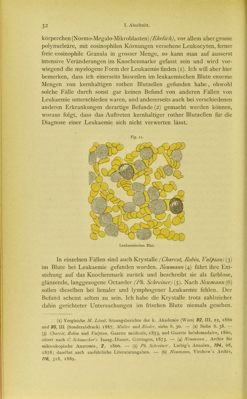 körperchen (Normo-Megalo-Mikroblasten) (Ehrlich), vor allem aber grosse polynucleäre, mit eosinophilen Körnungen versehene Leukocyten, ferner freie eosinophile Granula in grosser Menge, so kann man auf äusserst intensive Veränderungen im Knochenmarke gefasst sein und wird vor- wiegend die myelogene Form der Leukaemie finden (i). Ich will aber hier bemerken, dass ich einerseits bisweilen im leukaemischen Blute enorme Mengen von kernhaltigen rothen Blutzellen gefunden habe, obwohl solche Fälle durch sonst gar keinen Befund von anderen Fällen von Leukaemie unterschieden waren, und andererseits auch bei verschiedenen anderen Erkrankungen derartige Befunde (2) gemacht werden können, woraus folgt, dass das Auftreten kernhaltiger rother Blutzellen für die Diagnose einer Leukaemie sich nicht verwerten lässt. Fig. 11. In einzelnen Fällen sind auch Krystalle (Charcot, Robin, Vulpian) (3) im Blute bei Leukaemie gefunden worden. Neumann (4) führt ihre Ent- stehung auf das Knochenmark zurück und beschreibt sie als farblose, glänzende, langgezogene Octaeder (Ph. Schreiner) (5). Nach Neumann iß) sollen dieselben bei lienaler und lymphogener Leukaemie fehlen. Der Befund scheint selten zu sein. Ich habe die Krystalle trotz zahlreicher dahin gerichteter Untersuchungen im frischen Blute niemals gesehen. (1) Vergleiche M. Löwit, Sitzungsberichte der k. Akademie (Wien) 92, III, 22, iSSb und 95, III (Sonderabdruck) 1887; Müller und Rieder, siehe S. 36. — (2) Siehe S. 38. — (3) Charcot, Robin und Vulpian, Gazette medicale, 1853, und Gazette hebdomadaire, iSüo, citiert nach C. Schauschor s Inaug.-Dissert. Göttingen, 1S73* — (4) Neumann , Archiv für mikroskopische Anatomie, 2, 1866. — (5) Ph. Schreiner, Liebig’s Annalen, 194, 68, 1878; daselbst auch ausführliche Literaturangaben. — (6) Neumann, Virchow’s Archiv, 116, 318, 1889.