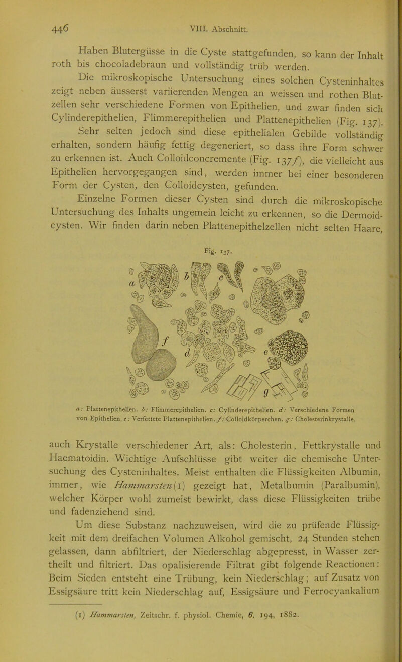 Haben Blutergüsse in die Cyste stattgefunden, so kann der Inhalt roth bis chocoladebraun und vollständig trüb werden. Die mikroskopische D ntersuchung eines solchen Cysteninhaltes zeigt neben äusserst variierenden Mengen an weissen und rothen Blut- zellen sehr verschiedene Formen von Epithelien, und zwar finden sich Cylinderepithelien, Flimmerepithelien und Plattenepithelien (Fig. 137). Sehr selten jedoch sind diese epithelialen Gebilde vollständig erhalten, sondern häufig fettig degeneriert, so dass ihre Form schwer zu erkennen ist. Auch Colloidconcremente (Fig. 137/j, die vielleicht aus Epithelien hervorgegangen sind, werden immer bei einer besonderen Form der Cysten, den Colloidcysten, gefunden. Einzelne Formen dieser Cysten sind durch die mikroskopische Untersuchung des Inhalts ungemein leicht zu erkennen, so die Dermoid- cysten. Wir finden darin neben Plattenepithelzellen nicht selten Haare, Fig. 137. a: Plattenepithelien. b: Flimmerepithelien. c: Cylinderepithelien. d: Verschiedene Formen von Epithelien. e: Verfettete Plattenepithelien./: Colloidkörperchen. g: Cholesterinkrystalle. auch Krystalle verschiedener Art, als: Cholesterin, Fettkrystalle und Haematoidin. Wichtige Aufschlüsse gibt weiter die chemische Unter- suchung des Cysteninhaltes. Meist enthalten die Flüssigkeiten Albumin, immer, wie Hammarstcn{\) gezeigt hat, Metalbumin (Paralbumin), welcher Körper wohl zumeist bewirkt, dass diese Flüssigkeiten trübe und fadenziehend sind. Um diese Substanz nachzuweisen, wird die zu prüfende Flüssig- keit mit dem dreifachen Volumen Alkohol gemischt, 24 Stunden stehen gelassen, dann abfiltriert, der Niederschlag abgepresst, in Wasser zer- theilt und filtriert. Das opalisierende Filtrat gibt folgende Reactionen: Beim Sieden entsteht eine Trübung, kein Niederschlag; auf Zusatz von Essigsäure tritt kein Niederschlag auf, Essigsäure und Ferrocyankalium (1) Hammarsten, Zeitschr. f. pliysiol. Chemie, 6, 194, 18S2.