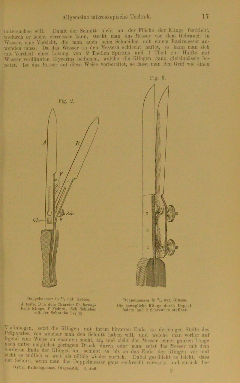 untersuchen will. Damit der Schnitt nicht an der Flüche der Klinge festklebt, wodurch er leicht zerreissen kann, steckt man das Messer vor dem Gebrauch in Wasser, eine Vorsicht, die man auch beim Schneiden mit einem Rasirmesscr an- wenden muss. Da das Wasser an den Messern schlecht hattet, so kann man sich mit Vortheil einer Lösung von 2 Theilen Spiritus und 1 Tbeil zur Hälfte mit Wasser verdünnten Glycerins bedienen, welche die Klingen ganz gleichmässig be- netzt. Ist das Messer auf diese Weise vorbereitet, so fasst man den Griff wie einen Fig. 3. Doppelmesser in 1 2 nat. Grösse. Doppelmesser in 3/< nat. Grösse. A feste, B in (lern Charnier Ch beweg- Die bewegliche Klinge durch Doppel- liehe Klinge, 1* Federn, Scli Schiebor federn und 2 Sclmiuben stellbar, mit der Schraube bei X \ iolinbogen, setzt die Klingen mit ihrem hinteren Ende an derjenigen Stelle des raparates, von welcher man den Schnitt haben will, und welche man vorher auf ugend eine Weise zu spannen sucht, an, und zieht das Messer seiner ganzen Länge nach unter möglichst geringem Druck durch oder man setzt das Messer mit dem vorderen Ende der Klingen an, schiebt es bis an das Ende der Klingen vor und zn-lit es endlich so weit als milbig wieder zurück. Dabei geschieht, es leicht, dass f er i-chmtt, wenn man das Doppelmesser ganz senkrecht vorwärts und zurück bc- Orth, Patholog.-anat. Diagnostik. 6. Aufl. o