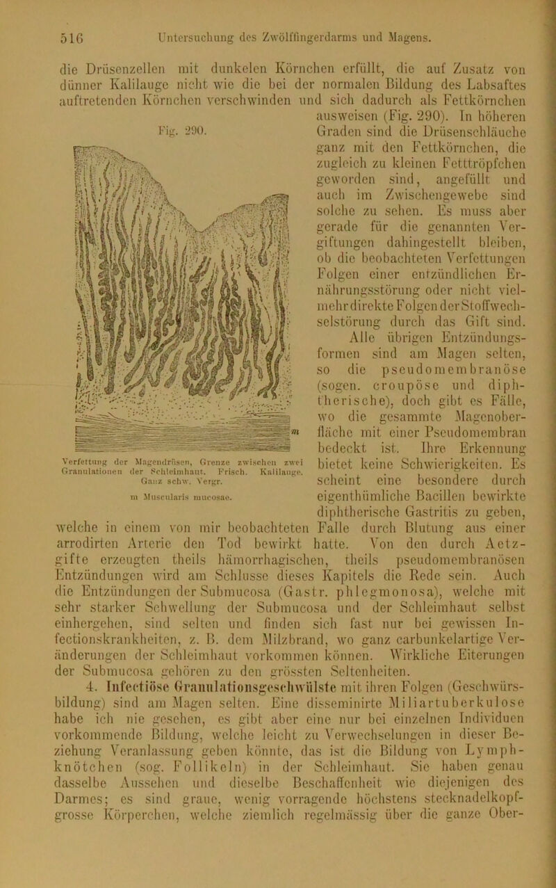 die Drüsenzellen mit dunkelen Körnchen erfüllt, die auf Zusatz von dünner Kalilauge nicht wie die bei der normalen Bildung des Labsaftes id sich dadurch als Fettkörnchen ausweisen (Fig. 290). In höheren Graden sind die Drüsenschläuche ganz mit den Fettkörnchen, die zugleich zu kleinen Fetttröpfchen geworden sind, angefüllt und auch im Zwischengewebe sind solche zu sehen. Es muss aber gerade für die genannten Ver- giftungen dahingestellt bleiben, ob die beobachteten Verfettungen Folgen einer entzündlichen Er- nährungsstörung oder nicht viel- mehrdirekte Folgen derStoffwech- selstörung durch das Gift sind. Alle übrigen Entzündungs- formen sind am Magen selten, so die pseudomembranöse (sogen, croupöse und diph- therische), doch gibt es Fälle, wo die gesummte Magcnober- fläche mit einer Pseudomembran bedeckt ist. Ihre Erkennung bietet keine Schwierigkeiten. Es scheint eine besondere durch eigenthiimliche Bacillen bewirkte diphtherische Gastritis zu geben, Falle durch Blutung aus einer hatte. Von den durch Aetz- gifte erzeugten thcils hämorrhagischen, theils pseudomembranösen Entzündungen wird am Schlüsse dieses Kapitels die Rede sein. Auch die Entzündungen der Submucosa (Gastr. phlegmonosa), welche mit sehr starker Schwellung der Submucosa und der Schleimhaut selbst einhergehen, sind selten und finden sich fast nur bei gewissen In- fectionskrankheitcn, z. B. dem Milzbrand, wo ganz carbunkelartige Ver- ünderungen der Schleimhaut Vorkommen können. Wirkliche Eiterungen der Submucosa gehören zu den grössten Seltenheiten. 4. Infectiöse Graimlatioiisgeschwiilste mit ihren Folgen (Geschwürs- bildung) sind am Magen selten. Eine disseminirte Miliartuberkulose habe ich nie gesehen, es gibt aber eine nur bei einzelnen Individuen vorkommende Bildung, welche leicht zu Verwechselungen in dieser Be- ziehung Veranlassung geben könnte, das ist die Bildung von Lymph- knötchen (sog. Follikeln) in der Schleimhaut. Sic haben genau dasselbe Aussehen und dieselbe Beschaffenheit wie diejenigen des Darmes; es sind graue, wenig vorragende höchstens stecknadelkopf- grosse Körperchen, welche ziemlich regelmässig über die ganze Ober- auftretenden Körnchen verschwinden u Fig. 290. Verfettung der Magcndriisen, Grenze zwischen zwei Granulationen der Schleimhaut. Frisch. Kalilauge. Ganz schw. Yergr. m MtisciUaris mucosae. welche in einem von mir beobachteten arrodirten Arterie den Tod bewirkt