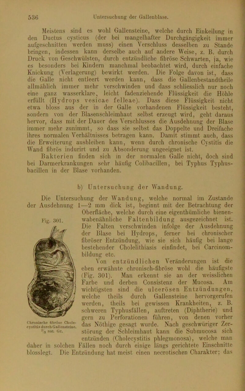 Meistens sind es wohl Gallensteine, welche durch Einkeilung in den Ductus cysticus (der bei mangelhafter Durchgängigkeit immer aufgeschnitten werden muss) einen Verschluss desselben zu Stande bringen, indessen kann derselbe auch auf andere Weise, z. B. durch Druck von Geschwülsten, durch entzündliche fibröse Schwarten, ja, wie es besonders bei Kindern manchmal beobachtet wird, durch einfache Knickung (Verlagerung) bewirkt werden. Die Folge davon ist, dass die Galle nicht entleert werden kann, dass die Gallenbestandtheile allmählich immer mehr verschwinden und dass schliesslich nur noch eine ganz wasserklare, leicht fadenziehende Flüssigkeit die Höhle erfüllt (Hydrops vesicae felleae). Dass diese Flüssigkeit nicht etwa bloss aus der in der Galle vorhandenen Flüssigkeit besteht, sondern von der Blasenschleimhaut selbst erzeugt wird, geht daraus hervor, dass mit der Dauer des Verschlusses die Ausdehnung der Blase immer mehr zunimmt, so dass sie selbst das Doppelte und Dreifache ihres normalen Verhältnisses betragen kann. Damit stimmt auch, dass die Erweiterung ausbleiben kann, wenn durch chronische Cystitis die Wand fibrös indurirt und zu Absonderung ungeeignet ist. Bakterien finden sich in der normalen Galle nicht, doch sind bei Darmerkrankungen sehr häufig Colibacillen, bei Typhus Typhus- bacillen in der Blase vorhanden. b) Untersuchung der Wandung. Die Untersuchung der Wandung, welche normal im Zustande der Ausdehnung 1—2 mm dick ist, beginnt mit der Betrachtung der Oberfläche, welche durch eine eigentümliche bienen- wabenähnliche Faltenbildung ausgezeichnet ist. Die Falten verschwinden infolge der Ausdehnung der Blase bei Hydrops, ferner bei chronischer fibröser Entzündung, wie sie sich häufig bei lange bestehender Cholclithiasis einfindet, bei Carcinom- bildung etc. Von entzündlichen Veränderungen ist die eben erwähnte chronisch-fibröse wohl die häufigste (Fig. 301). Man erkennt sie an der weisslichen Farbe und derben Consistenz der Mucosa. Am wichtigsten sind die ulcerösen Entzündungen, welche theils durch Gallensteine hervorgerufen werden, t.hcils bei gewissen Krankheiten, z. B. schweren Typhusfällen, auftreten (Diphtherie) und gern zu Perforationen führen, von denen vorher das Nöthige gesagt wurde. Nach geschwüriger Zer- störung der Schleimhaut kann die Submucosa sich entzünden (Cholecystitis phlegmonosa), welche man daher in solchen Fällen noch durch einige längs gerichtete Einschnitte blosslegt. Die Entzündung hat meist, einen necrotischen Charakter; das Chronische fibröse Chole- cystitis durch Gallensteine. -/3 nat. Gr.