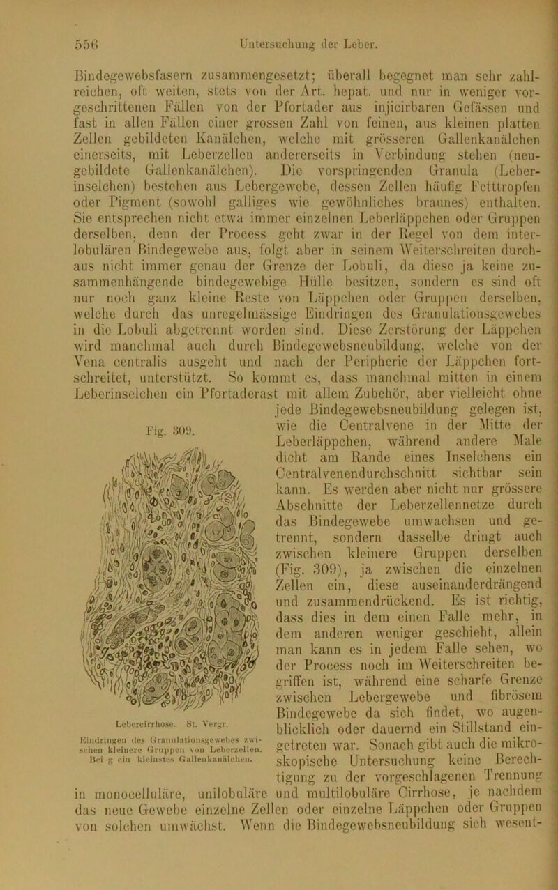 Fis. 309. Bindegewebsfasern zusammengesetzt; überall begegnet man sehr zahl- reichen, oft weiten, stets von der Art. hepat. und nur in weniger vor- geschrittenen Fällen von der Pfortader aus injicirbaren Gcfässen und fast in allen Fällen einer grossen Zahl von feinen, aus kleinen platten Zellen gebildeten Kanälchen, welche mit grösseren Gallenkanälchen einerseits, mit Leberzellen andererseits in Verbindung stehen (neu- gebildete Gallenkanälchen). Die vorspringenden Granula (Leber- inselchen) bestehen aus Lebergewebe, dessen Zellen häufig Fetttropfen oder Pigment (sowohl galliges wie gewöhnliches braunes) enthalten. Sie entsprechen nicht etwa immer einzelnen Leberläppchen oder Gruppen derselben, denn der Process geht zwar in der Regel von dem inter- lobulären Bindegewebe aus, folgt aber in seinem Weiterschreiten durch- aus nicht immer genau der Grenze der Lobuli, da diese ja keine zu- sammenhängende bindegewebige Hülle besitzen, sondern es sind oft nur noch ganz kleine Reste von Läppchen oder Gruppen derselben, welche durch das unregelmässige Eindringen des Granulationsgewebes in die Lobuli abgetrennt worden sind. Diese Zerstörung der Läppchen wird manchmal auch durch ßindegcwebsneubildung, welche von der Vena centralis ausgeht und nach der Peripherie der Läppchen fort- schreitet, unterstützt. So kommt es, dass manchmal mitten in einem Leberinselchen ein Pfortaderast mit allem Zubehör, aber vielleicht ohne jede Bindegewebsncubildung gelegen ist, wie die Centralvene in der Mitte der Leberläppchen, während andere Male dicht am Rande eines Inselchens ein Centralvenendurchschnitt sichtbar sein kann. Es werden aber nicht nur grössere Abschnitte der Leberzellennetze durch das Bindegewebe umwachsen und ge- trennt, sondern dasselbe dringt auch zwischen kleinere Gruppen derselben (Fig. 309), ja zwischen die einzelnen Zellen ein, diese auseinanderdrängend und zusammendrückend. Es ist richtig, dass dies in dem einen Falle mehr, in dem anderen weniger geschieht, allein man kann es in jedem Falle sehen, wo der Process noch im Weiterschreiten be- griffen ist, während eine scharfe Grenze zwischen Lebergewebe und fibrösem Bindegewebe da sich findet, wo augen- blicklich oder dauernd ein Stillstand ein- getreten war. Sonach gibt auch die mikro- skopische Untersuchung keine Berech- tigung zu der vorgeschlagenen Trennung in monocelluläre, unilobulärc und multilobuläre Cirrhose, je nachdem das neue Gewebe einzelne Zellen oder einzelne Läppchen oder Gruppen von solchen umwächst. Wenn die Bindegewebsneubildung sich wesent- Lebercirrhose. St. Vergr. Eindringen des Grannlntiousgewehes •/.wi- schen kleinere Gruppen von Lebensellen. Bei g ein kleinstes Gallenkanalehen.