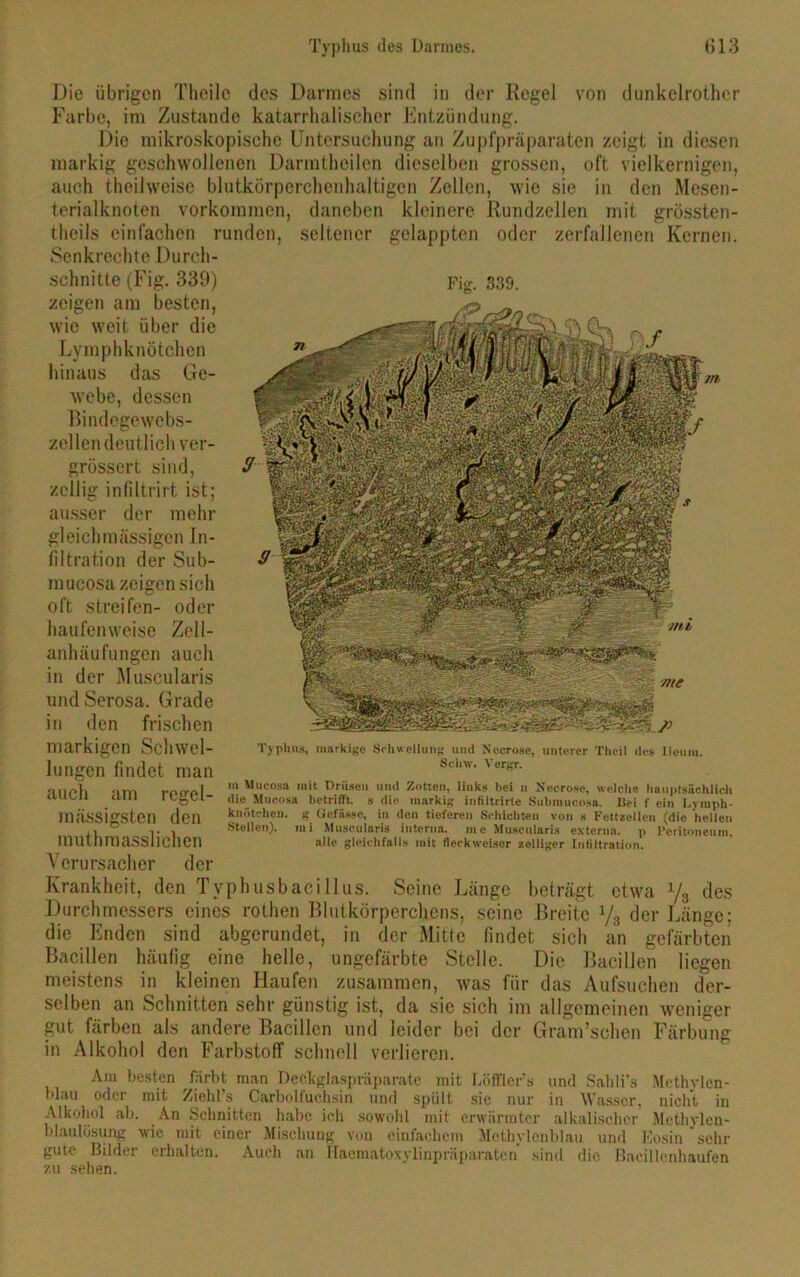 Die übrigen Theile des Darmes sind in der Regel von dunkelrothcr Farbe, im Zustande katarrhalischer Entzündung. Die mikroskopische Untersuchung an Zupfpräparaten zeigt in diesen markig geschwollenen Darmtheilen dieselben grossen, oft vielkernigen, auch theilweise blutkörperchenhaltigen Zellen, wie sie in den Mesen- terialknoten Vorkommen, daneben kleinere Rundzellen mit grössten- theils einfachen runden, seltener gelappten oder zerfallenen Kernen. Senkrechte Durch- schnitte (Fig. 339) Fig. 339. zeigen am besten, wie weit über die Lymphknötchen hinaus das Ge- webe, dessen Bindegewebs- zellen deutlich ver- grössert sind, zellig infiltrirt ist; ausser der mehr gleichmässigen In- filtration der Sub- mucosa zeigen sich oft streifen- oder haufenweise Zell- anhäufungen auch in der Muscularis und Serosa. Grade den frischen in markigen Schwel- lungen findet man auch am regel- mässigsten den muthmasslichen Verursacher der Krankheit, den Typhusbacillus. Seine Länge beträgt etwa Durchmessers eines rothen Blutkörperchens, seine Breite x/3 der die Enden sind abgerundet, in der Mitte findet sich an gefärbten Bacillen häufig eine helle, ungefärbte Stelle. Die Bacillen liegen meistens in kleinen Haufen zusammen, was für das Aufsuchen der- selben an Schnitten sehr günstig ist, da sie sich im allgemeinen weniger gut färben als andere Bacillen und leider bei der Gram’schen Färbung in Alkohol den Farbstoff schnell verlieren. Typhus, markige Schwellung und Seerose, unterer Thcil des Ileum. Sehw. Vergr. m Mucosa mit Drüsen und Zotten, links hei n Seerose, welche hauptsächlich die Mucosa betrifft, s die markig infiltrirte Submuco.sa. Bei f ein Lymph- knötchen. g Uefiis.se, in den tieferen Schichten von s Fettzellen (die hellen Stellen), ini Muscularis interna, me Muscularis externa, p l’critonenm, alle gleichfalls mit fleckweiser zelliger Infiltration. Vs des Länge: Am besten färbt man Deckglaspräparate mit Löfflers und Sabli's Methylen- blau oder mit Zieht.s Carboifuchsin und spült sie nur in Wasser, nicht in Alkohol ab. An Schnitten habe ich sowohl mit erwärmter alkalischer Methylen- blaulösung wie mit einer Mischung von einfachem Methylenblau und Kosin sehr gute Bilder erhalten. Auch an Haematoxylinpräparatcn sind die Bacillenhaufen zu sehen.