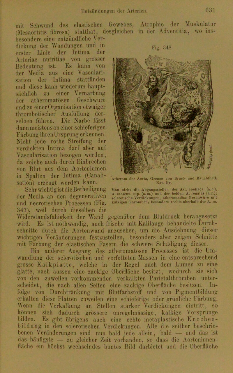 mit. Schwund des elastischen Gewebes, Atrophie der Muskulatur (Mcsaortitis iibrosa) statthat, desgleichen in der Adventitia, wo ins- besondere eine entzündliche Ver- dickung der Wandungen und in Fig ;M8 erster Linie der Intima der Arteriae nutritiae von grosser Bedeutung ist. Es kann von der Media aus eine Vasculari- sation der Intima stattfinden und diese kann wiederum haupt- sächlich zu einer Vernarbung der atheromatösen Geschwüre und zu einer Organisation etwaiger thrombotischer Ausfüllung der- selben führen. Die Narbe lässt dann meistens an einer schieferigen Färbung ihrenürsprung erkennen. Nicht jede rothe Streifung der verdickten Intima darf aber auf Vascularisation bezogen werden, da solche auch durch Einbrechen von Blut aus dem Aortenlumen in Spalten der Intima (Canali- sation) erzeugt werden kann. Sehr wichtigist die Betheiligung der Media an den degenerativen und necrotischen Processen (Fig. 347), weil durch dieselben die Widerstandsfähigkeit der Wand gegenüber dem Blutdruck herabgesetzt wird. Es ist nothwendig, auch frische mit Kalilauge behandelte Durch- schnitte durch die Aortenwand anzusehen, um die Ausdehnung dieser wichtigen Veränderungen festzustellen, besonders aber zeigen Schnitte mit Färbung der elastischen Fasern die schwere Schädigung dieser. Ein anderer Ansgang des atheromatösen Processes ist die Um- wandlung der sclerotischen und verfetteten Massen in eine entsprechend grosse Kalkplatte, welche in der Regel nach dem Lumen zu eine glatte, nach aussen eine zackige Oberfläche besitzt, wodurch sie sich von den zuweilen vorkomraenden verkalkten Parietalthromben unter- scheidet, die nach allen Seiten eine zackige Oberfläche besitzen. In- folge von Durchtränkung mit Blutfarbstoff und von Pigmcntbildung erhalten diese Platten zuweilen eine schieferige oder grünliche Färbung. Wenn die Verkalkung an Stellen starker Verdickungen cintritt, so können sich dadurch grössere unregelmässige, kalkige Vorsprünge bilden. Es gibt übrigens auch eine echte metaplastische Knochen- bildung in den sclerotischen Verdickungen. Alle die seither beschrie- benen Veränderungen sind nun bald jede allein, bald — und das ist das häufigste — zu gleicher Zeit vorhanden, so dass die Aorteninnen- fläche ein höchst wechselndes buntes Bild darbietet und die Oberfläche Atherom der Aorta, Grenze von Brust- und Baueinheit. Nat. Gr. Man sieht die Abgangsstellen der Art. coeliaca (a.c.), A. mesent. snp. (a.m.) und der beiden A. renales (a.r.); sclerotische Verdickungen, athoromatöse Geschwüre mit kalkigen Thrombeiii besonders rechts oberhalb der A. m.