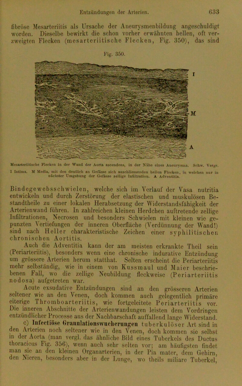 fibröse Mesarteriitis als Ursache der Aneurysmenbildung angeschuldigt worden. Dieselbe bewirkt die schon vorher erwähnten hellen, oft ver- zweigten Flecken (mesarteriitische Flecken, Fig. 350), das sind Fig. 350. Mesarteriitische Flecken in der Wand der Aorta ascendens, in der Nähe eines Aneurysma. Schw. Vergr. I Intima. M Media, mit den deutlich an Gefiisse sich anschliessenden hellen Flecken, in welchen nur in nächster Umgebung der Gefässe zellige Infiltration. A Adventitia. Bindege webssch wieien, welche sich im Verlauf der Vasa nutritia entwickeln und durch Zerstörung der elastischen und muskulösen Be- standteile zu einer lokalen Herabsetzung der Widerstandsfähigkeit der Arterienwand führen. In zahlreichen kleinen Herdchen auftretende zellige Infiltrationen, Necrosen und besonders Schwielen mit kleinen wie ge- punzten Vertiefungen der inneren Oberfläche (Verdünnung der Wand!) sind nach Heller charakteristische Zeichen einer syphilitischen chronischen Aortitis. Auch die Adventitia kann der am meisten erkrankte Theil sein (Periarteriitis), besonders wenn eine chronische indurative Entzündung um grössere Arterien herum statthat. Selten erscheint die Periarteriitis mehr selbständig, wie in einem von Kussmaul und Maier beschrie- benen Fall, wo die zellige Neubildung fleckweisc (Periarteriitis nodosa) aufgetreten war. Acute exsudative Entzündungen sind an den grösseren Arterien seltener wie an den Venen, doch kommen auch gelegentlich primäre eiterige Thromboarteriitis, wie fortgeleitete Periarteriitis vor. Die inneren Abschnitte der Arterienwandungen leisten dem Vordringen entzündlicher Processe aus der Nachbarschaft auffallend lange Widerstand. c) Infectiosc Granulationswucherungen tuberkulöser Art sind in den Arterien noch seltener wie in den Venen, doch kommen sie selbst in der Aorta (man vergl. das ähnliche Bild eines Tuberkels des Ductus thoracicus Fig. 356), wenn auch sehr selten vor; am häufigsten findet man sie an den kleinen Organarterien, in der Pia mater, dem Gehirn, den Nieren, besonders aber in der Lunge, wo theils miliare Tuberkel,